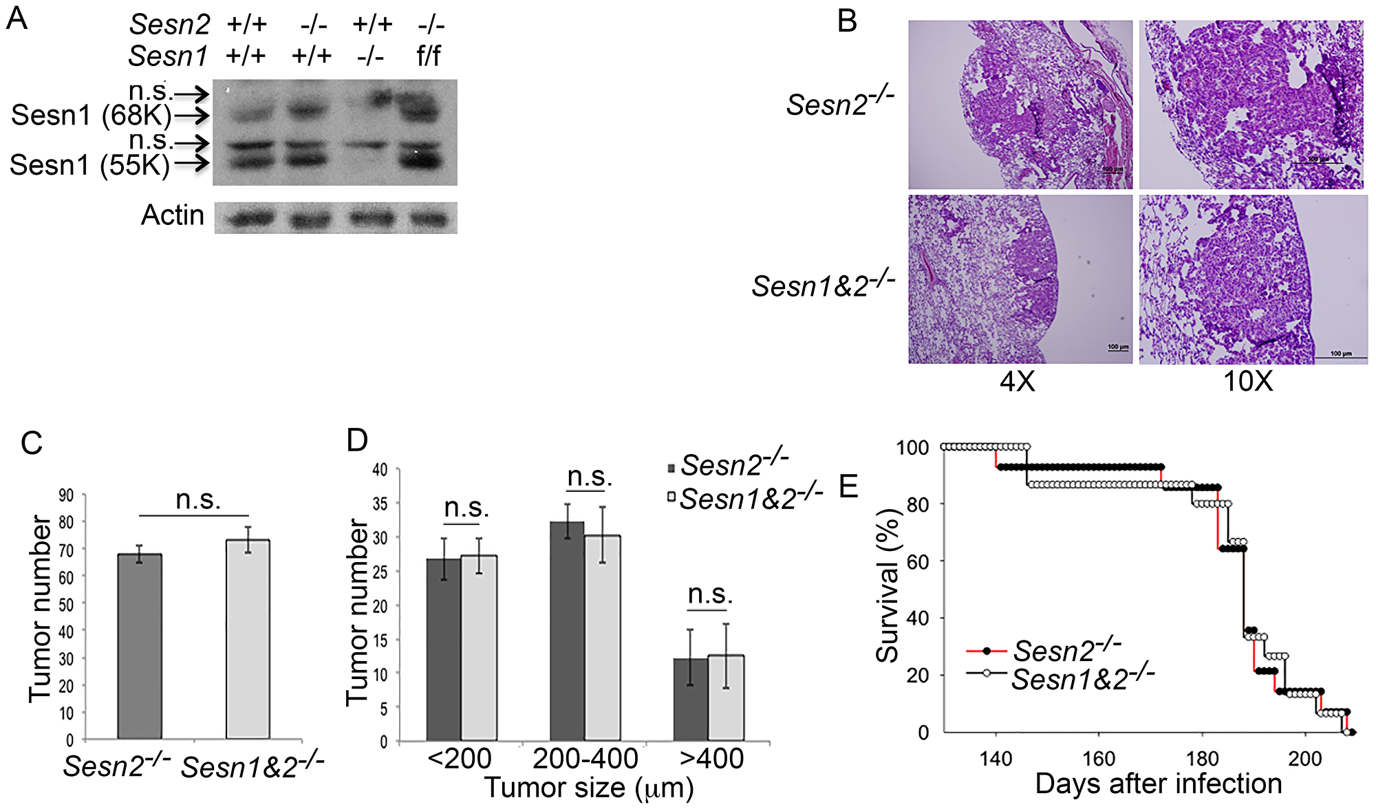 Inactivation of Sesn1 in Sesn2-/-;KrasLSL-G12D mice does not affect tumor phenotype