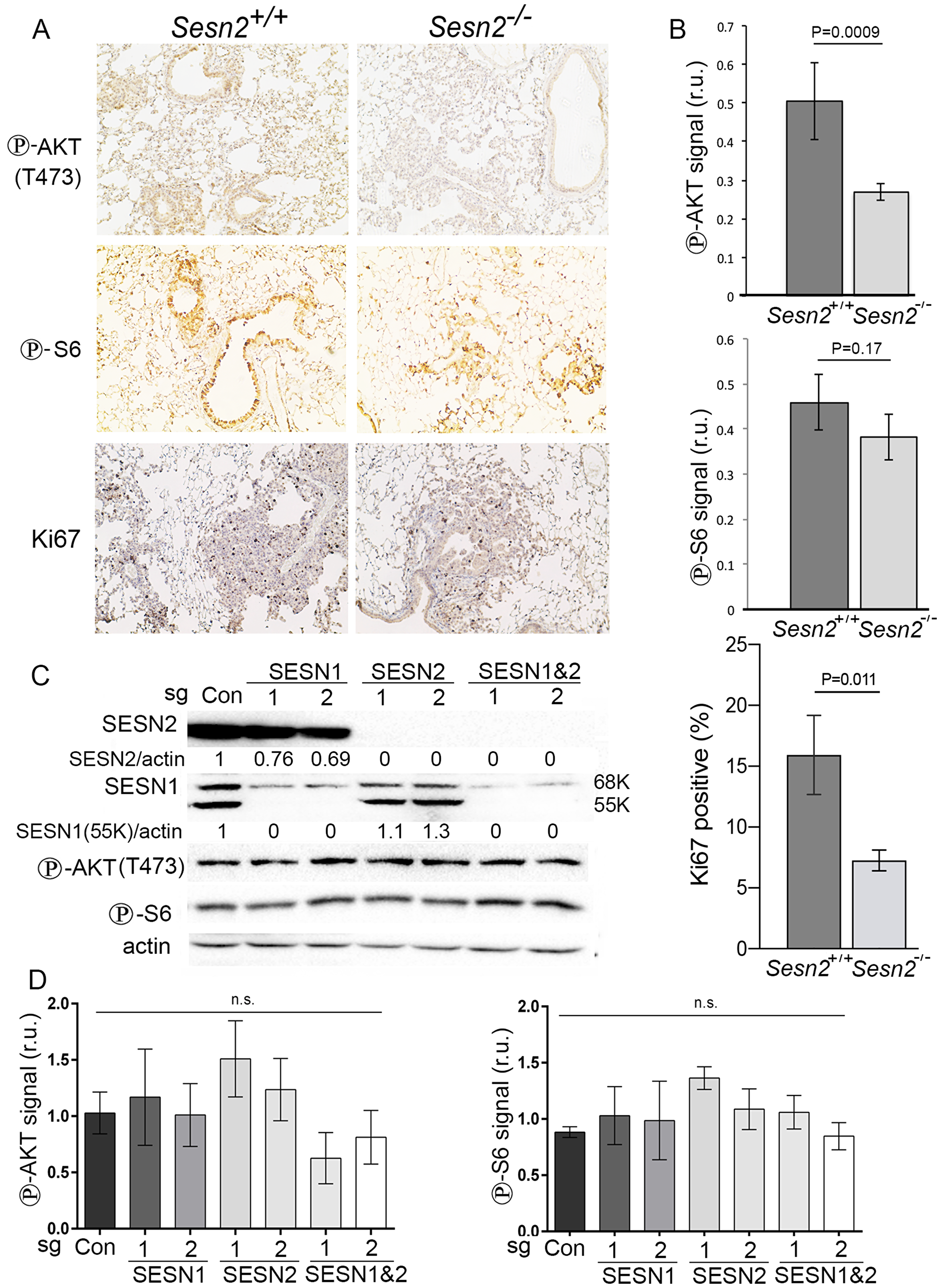Inactivation of Sesn2 diminishes phosphorylation of AKT