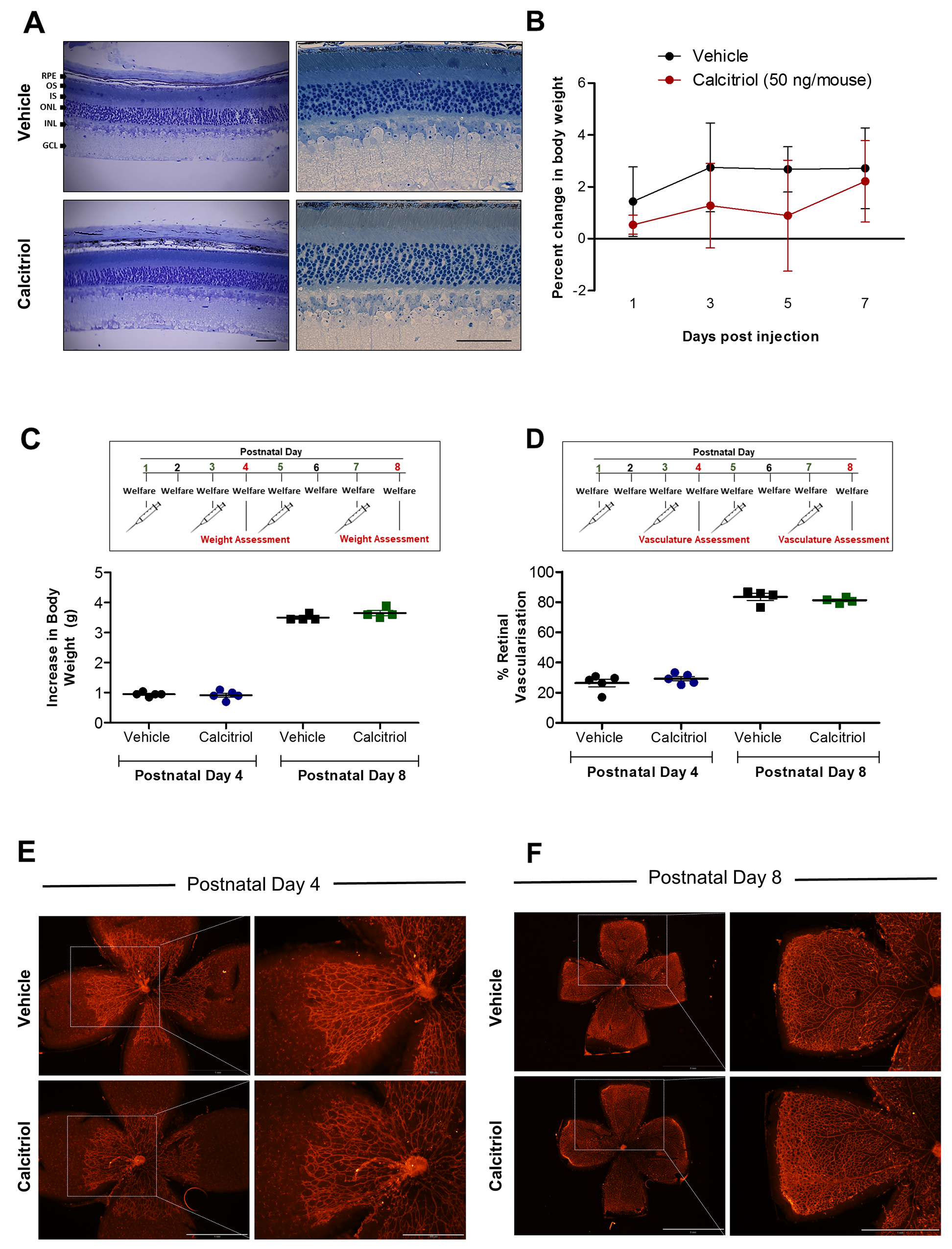 No ocular morphological defects were identified in mice treated with calcitriol and calcitriol treatment on alternating days does not attenuate superficial retinal vasculature development in C57BL/6J mice