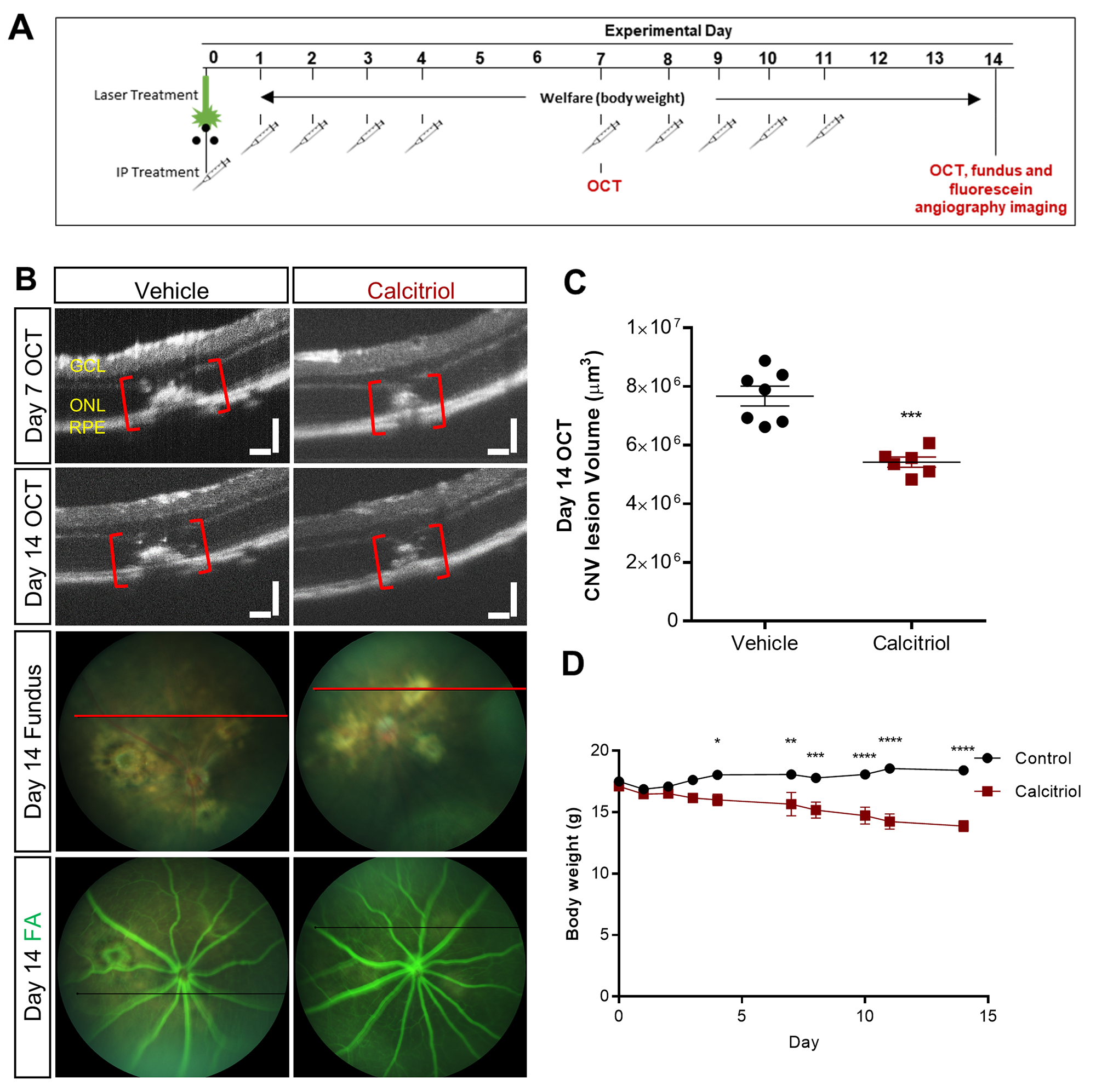 Effect of calcitriol on choroidal neovascularisation