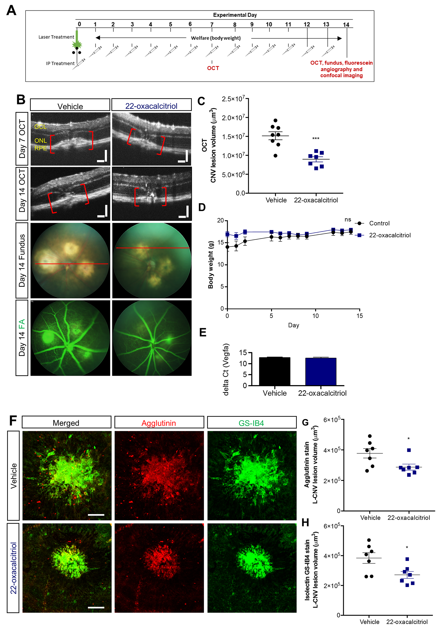 Effect of 22-oxacalcitriol on choroidal neovascularisation