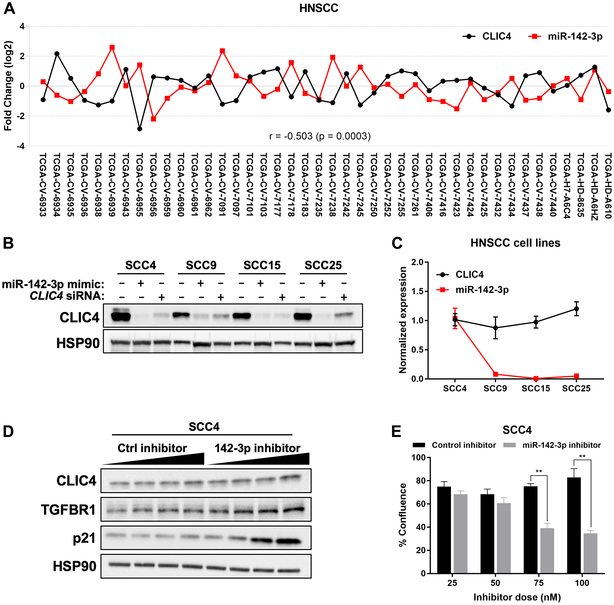 miR-142-3p modulates CLIC4 expression in HNSCC