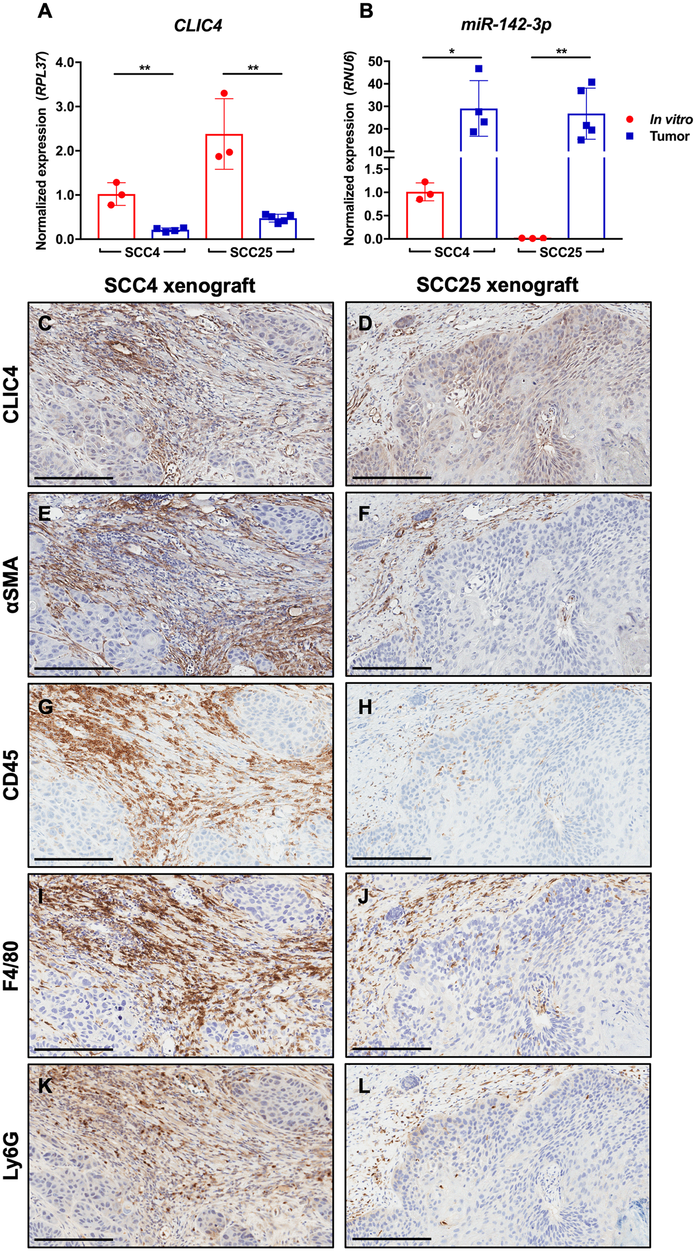 CLIC4 is downregulated in SCC xenografts concurrent with immune cell infiltration and miR-142-3p upregulation