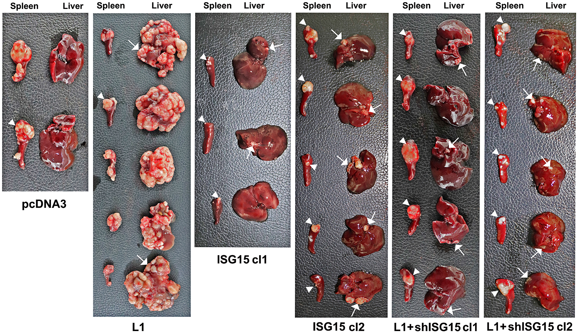 Overexpression of ISG15 enhances liver metastasis of CRC cells and ISG15 suppression in L1-overexpressing cells blocks metastasis