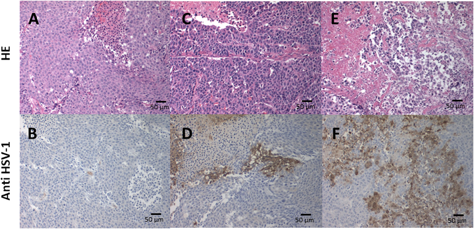 Immunohistochemical analysis of HSV-1 in xenograft tumors