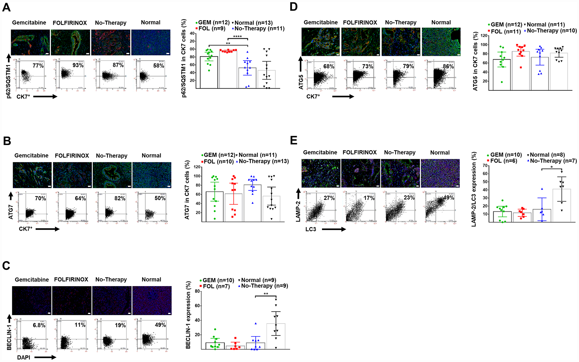 Human pancreatic normal and cancer tissues: expression of autophagy markers