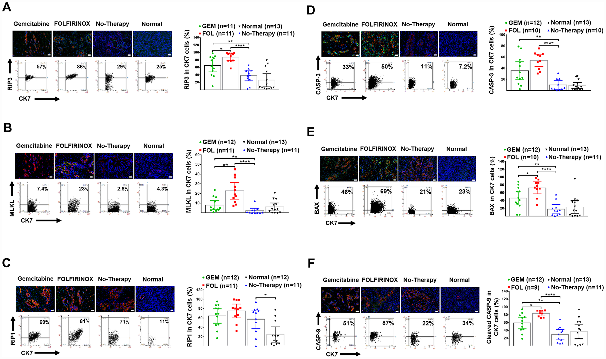Human pancreatic normal and cancer tissues: expression of necroptosis and apoptosis markers