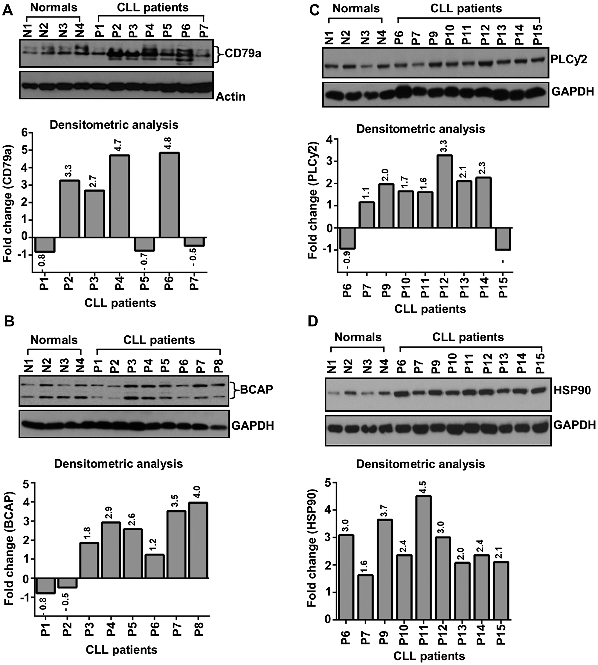 CLL cells aberrantly express CD79a, BCAP, PLCγ2 and HSP90