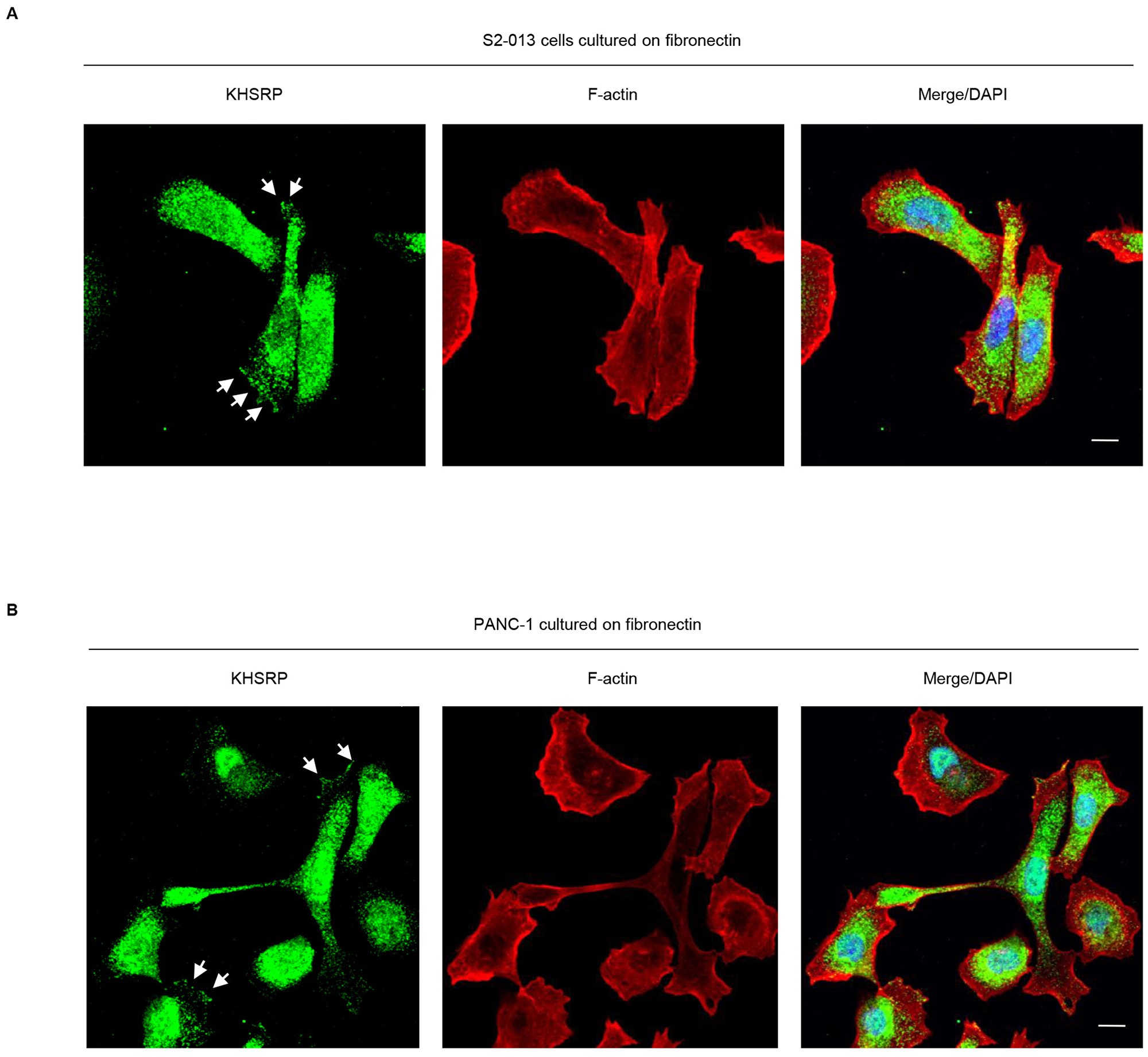 KHSRP distribution in PDAC cells