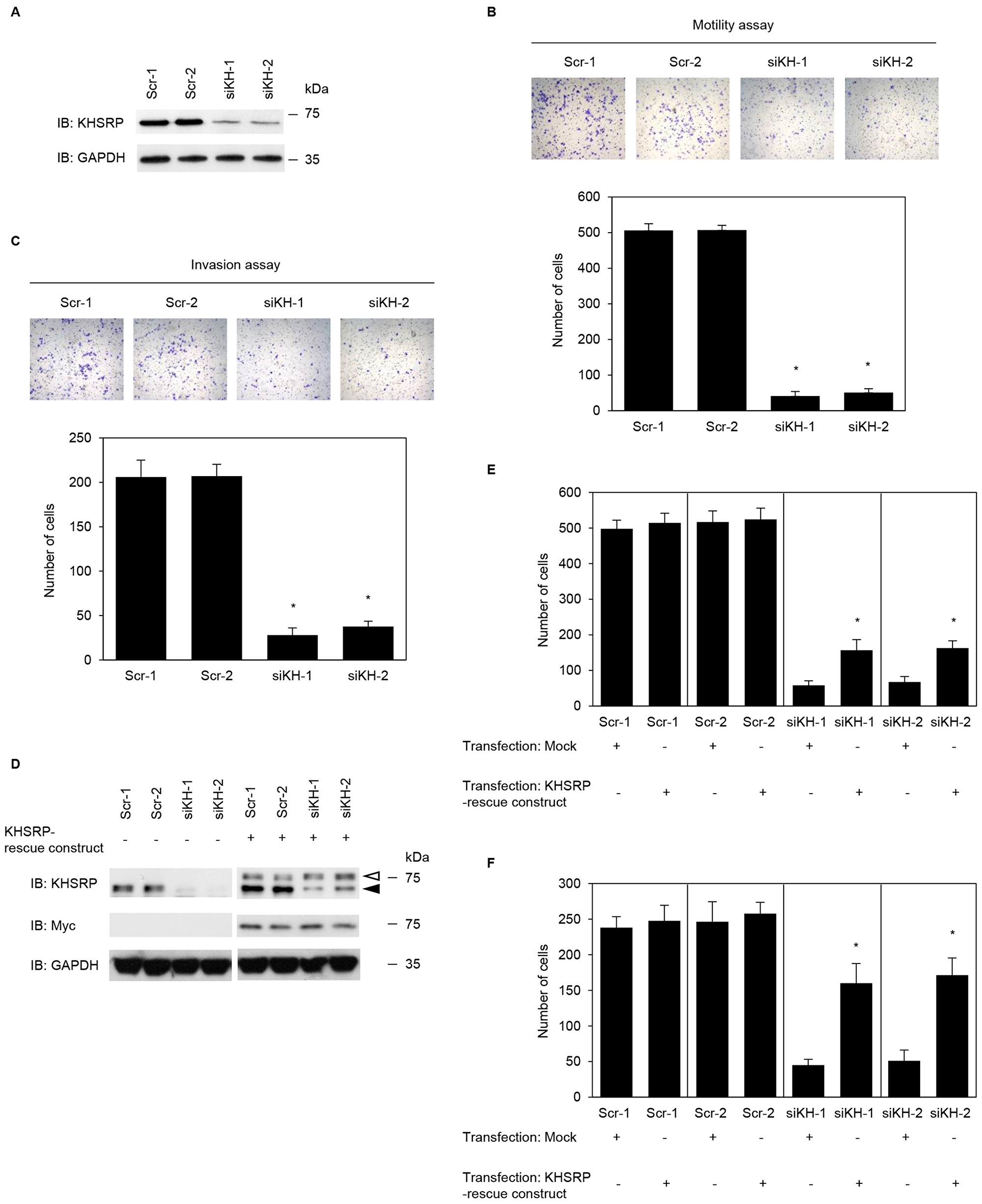 KHSRP promotes cell motility and invasion of PDAC cells