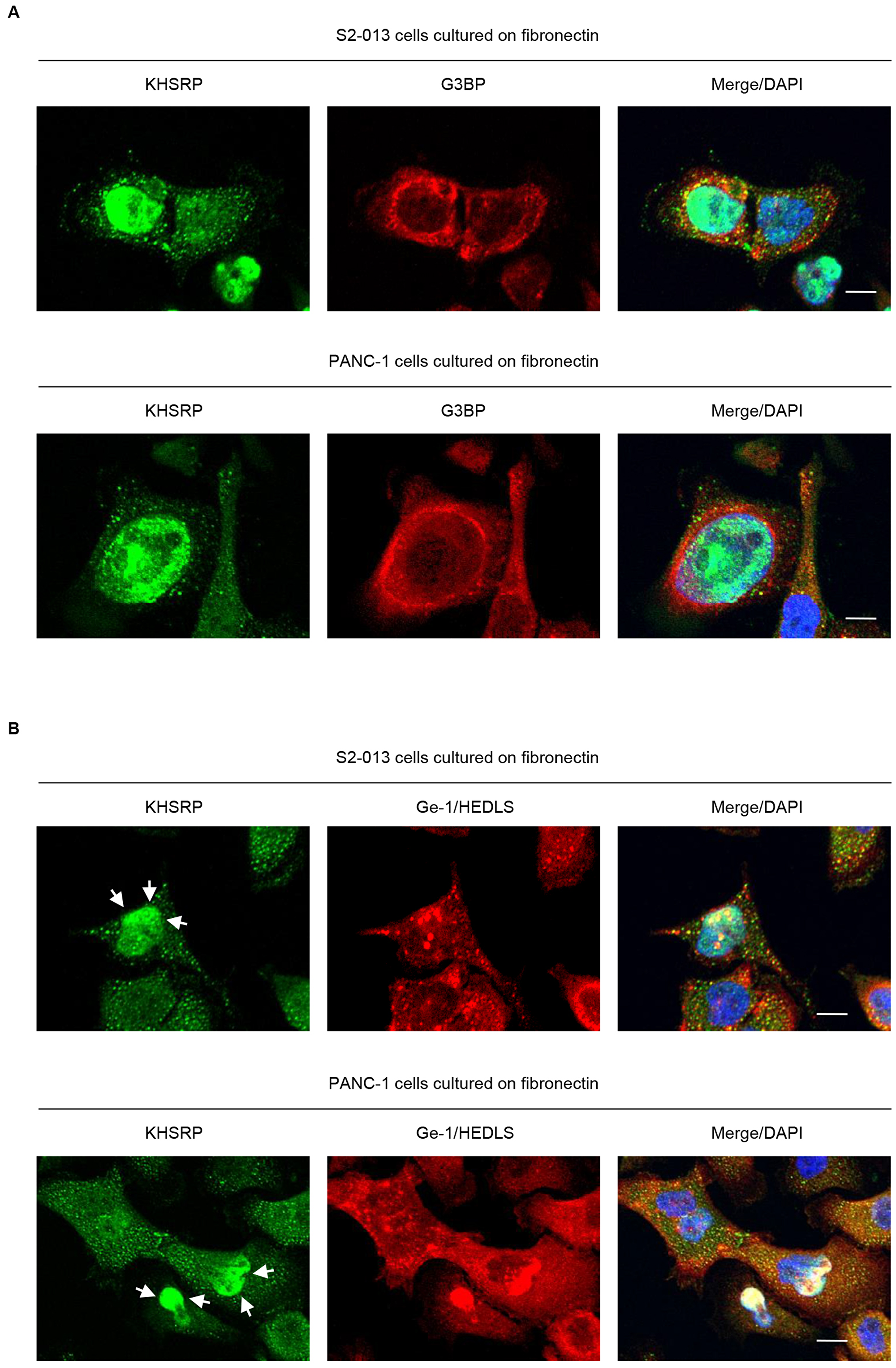 KHSRP localizes in cytoplasmic P-bodies