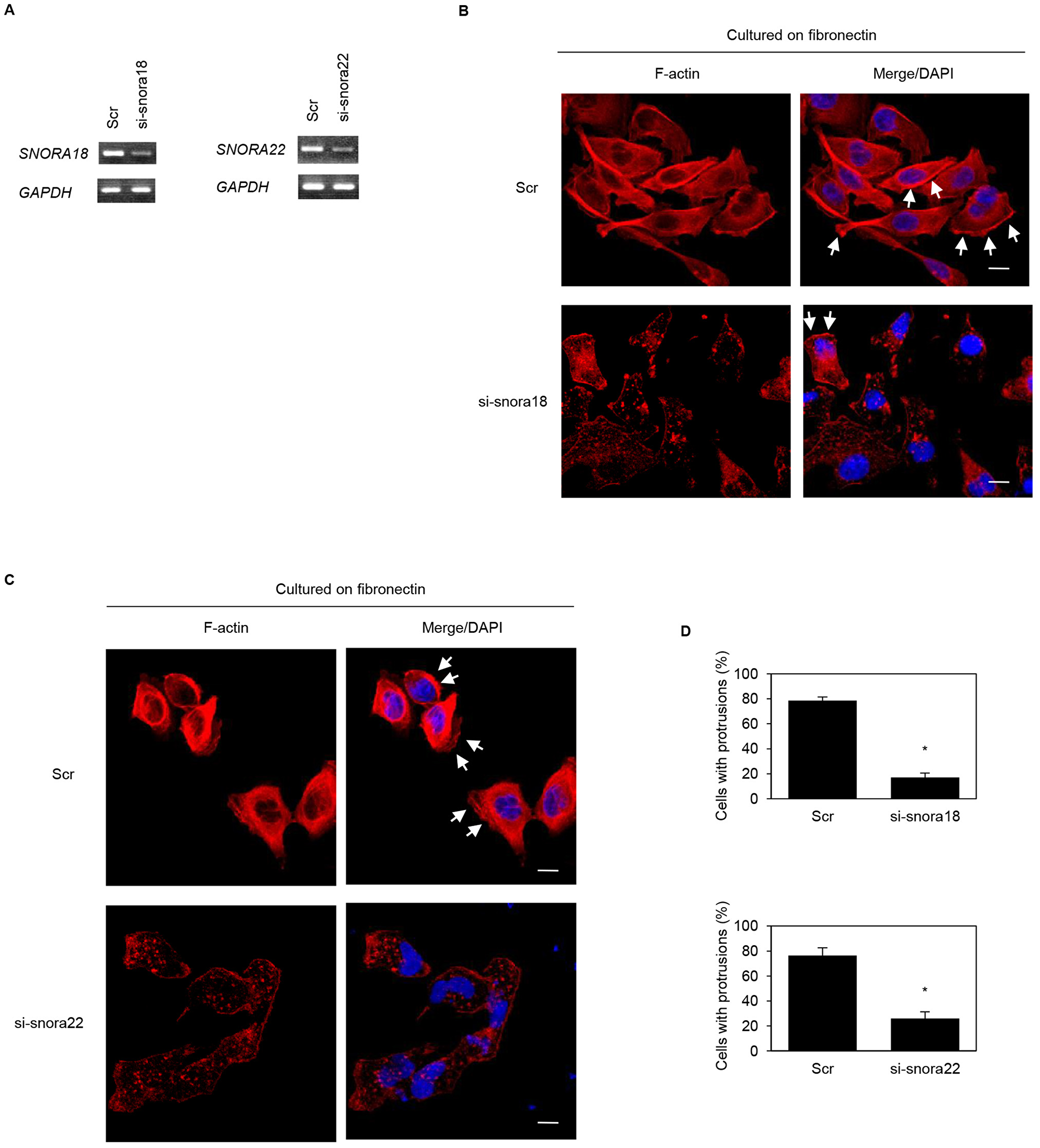 Roles of KHSRP-bound snoRNAs in forming cell protrusions in S2-013 cells
