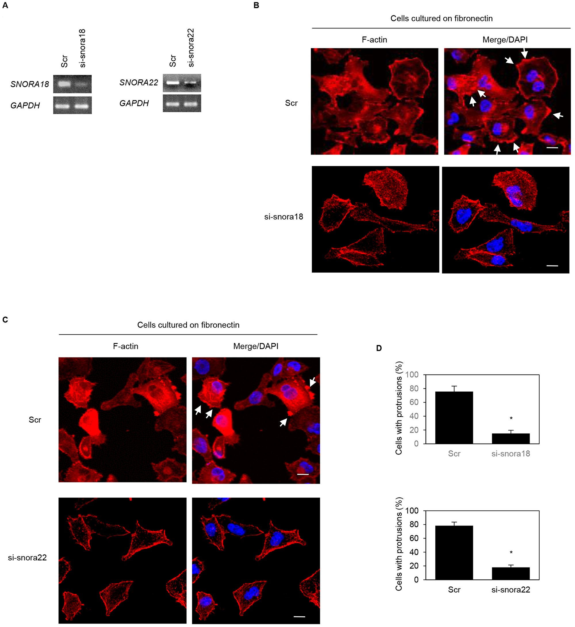 Roles of KHSRP-bound snoRNAs in forming cell protrusions in PANC-1 cells