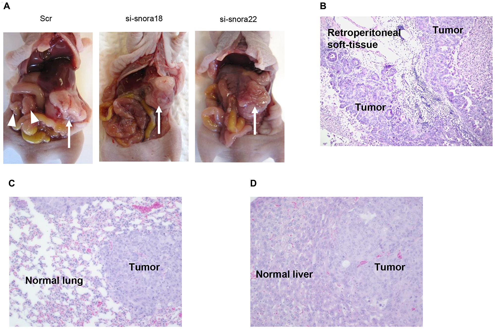 Knockdown effect of siRNA-FA-PEG-COL nanoparticles targeting KHSRP-bound snoRNAs on cell motility and invasion in the orthotopic murine model of PDAC