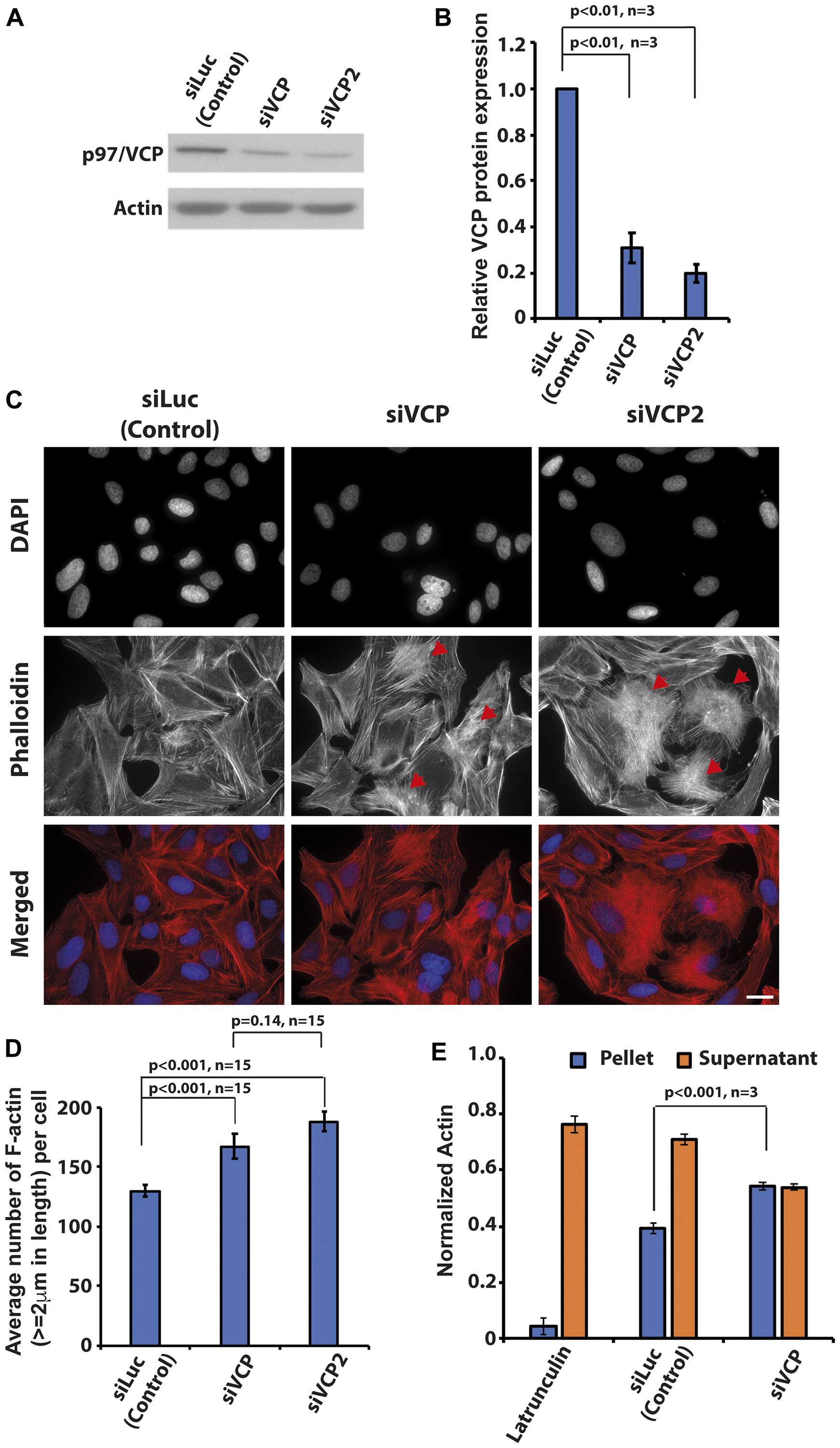 Knockdown of p97/VCP induced changes in actin morphology