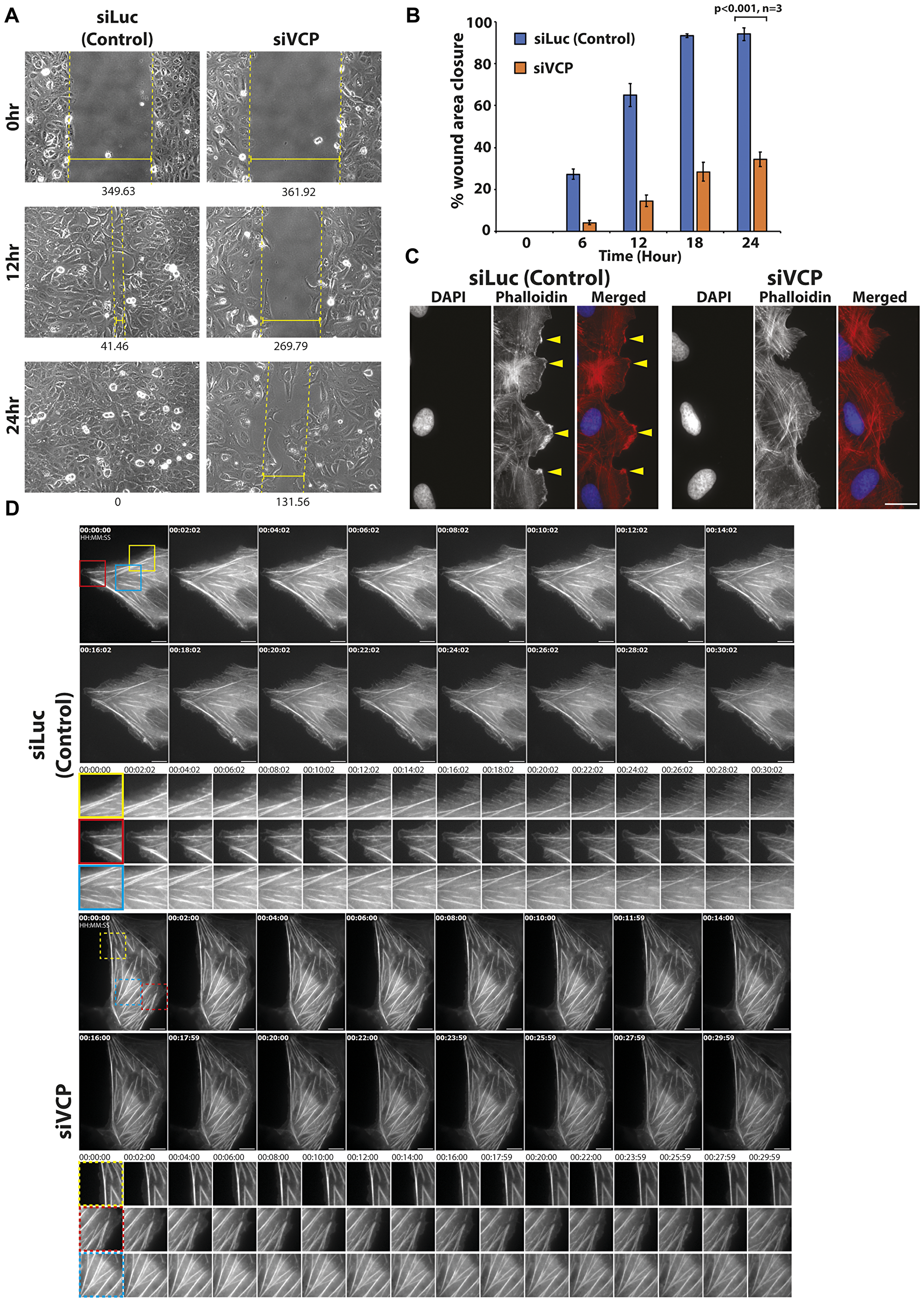 Knockdown of p97/VCP impaired proper cell migration