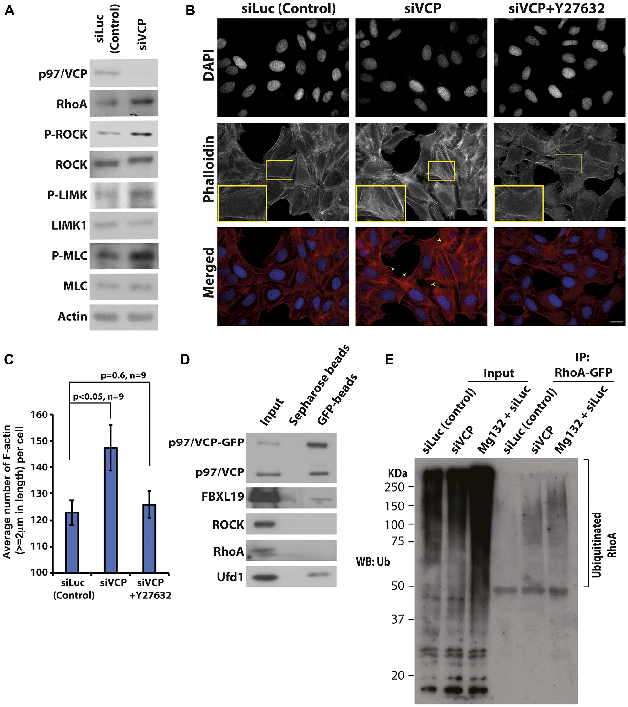 Loss of p97/VCP induces Rho-ROCK signaling pathway