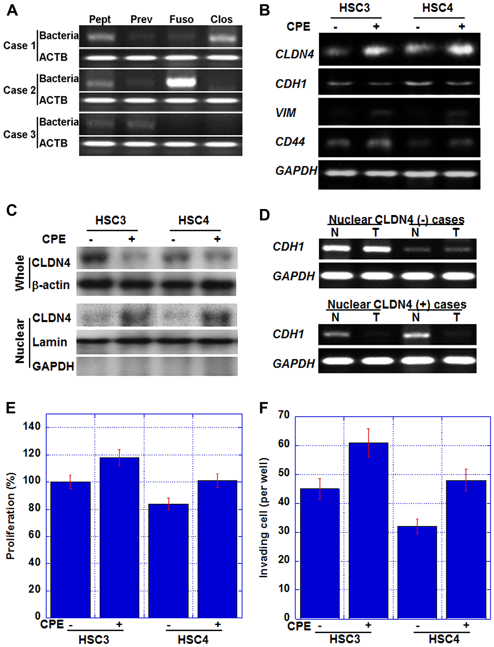 Effect of Clostridium perfringens enterotoxin (CPE) in human OSCC cell lines