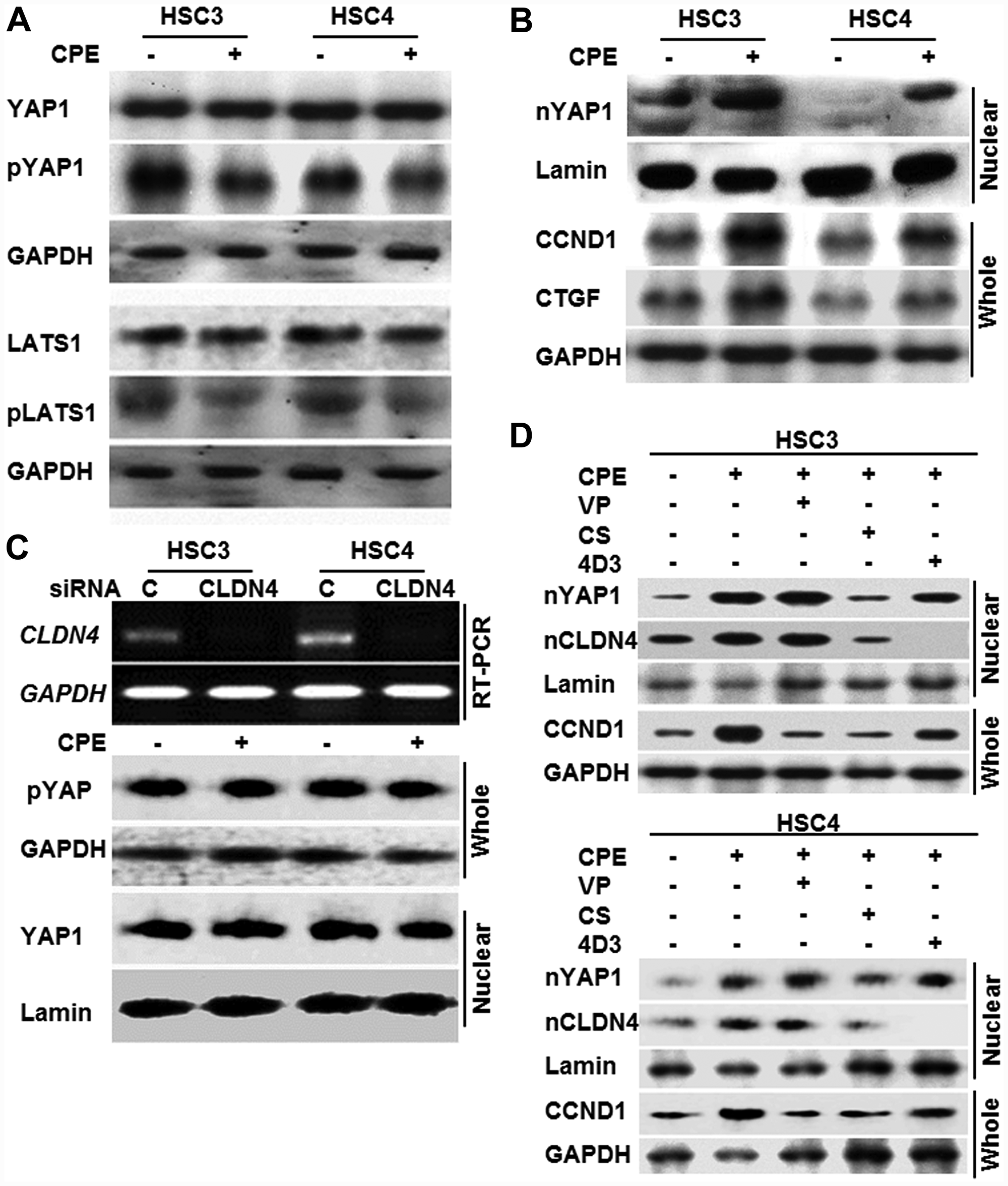 Effect of CPE on YAP1 activation in OSCC cells