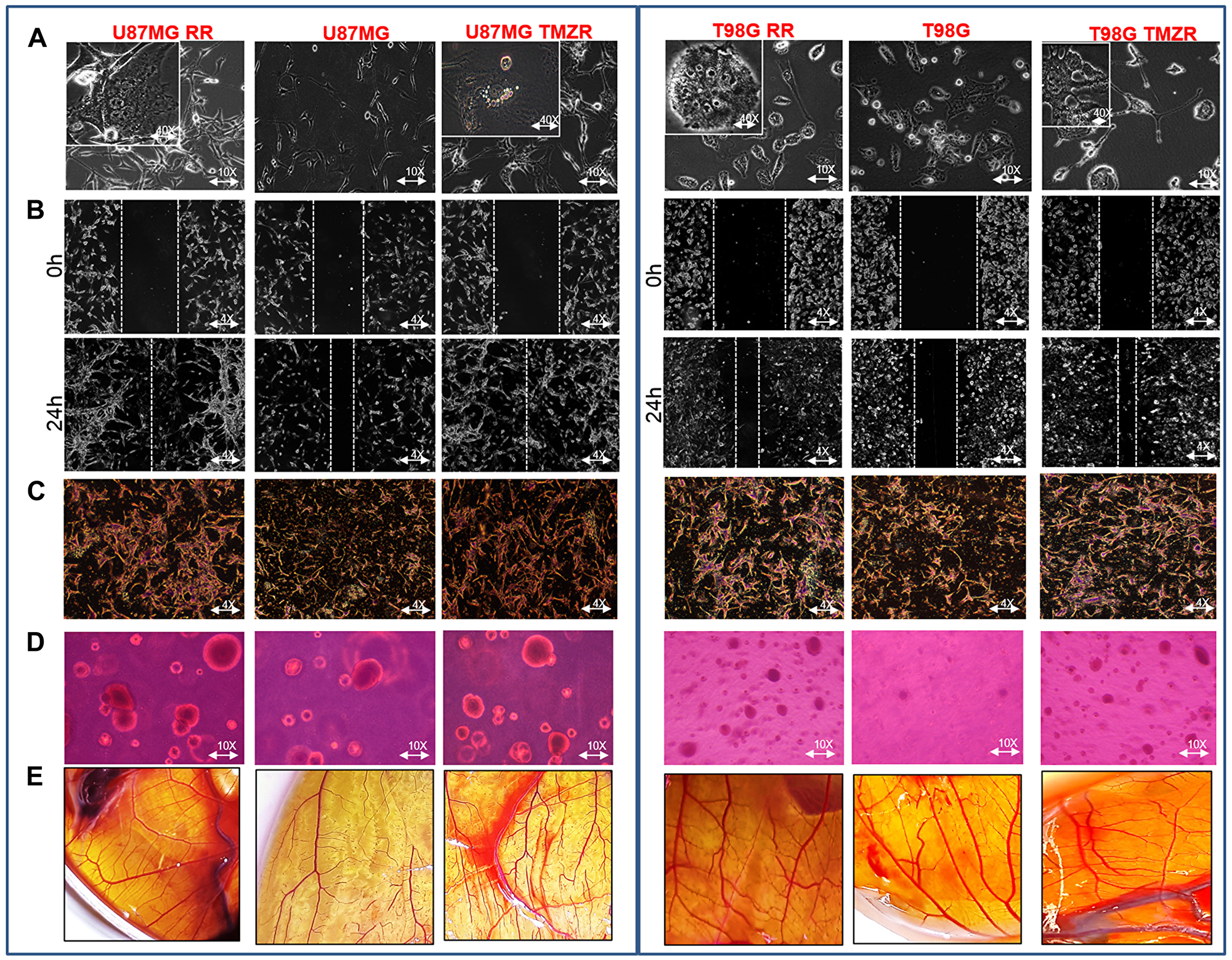 Characterization of radiation-resistant and TMZ-resistant (RR/TMZR) GBM cells
