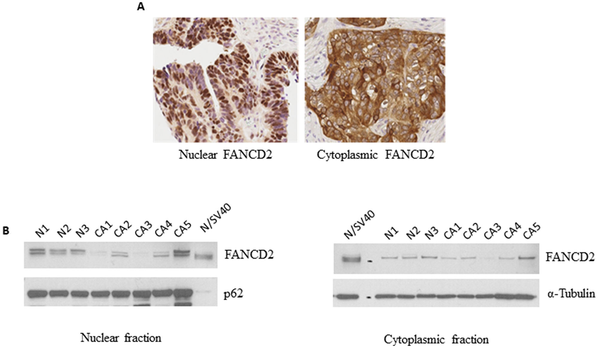 Figure 1: FANCD2 is present in the nucleus as well as the cytoplasm