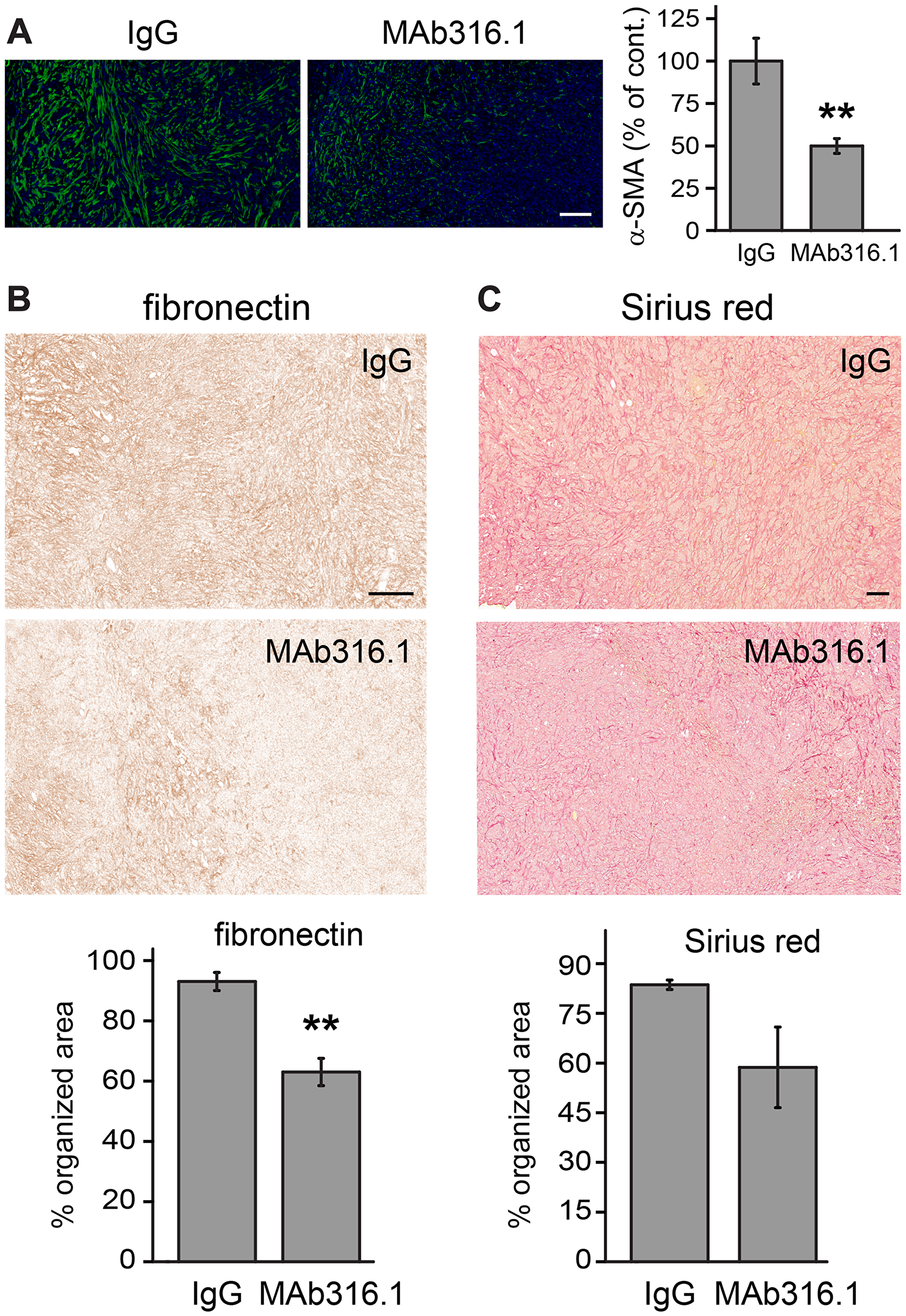 4T1 tumors from mice treated with MAb316.1 show decreased stromal participation