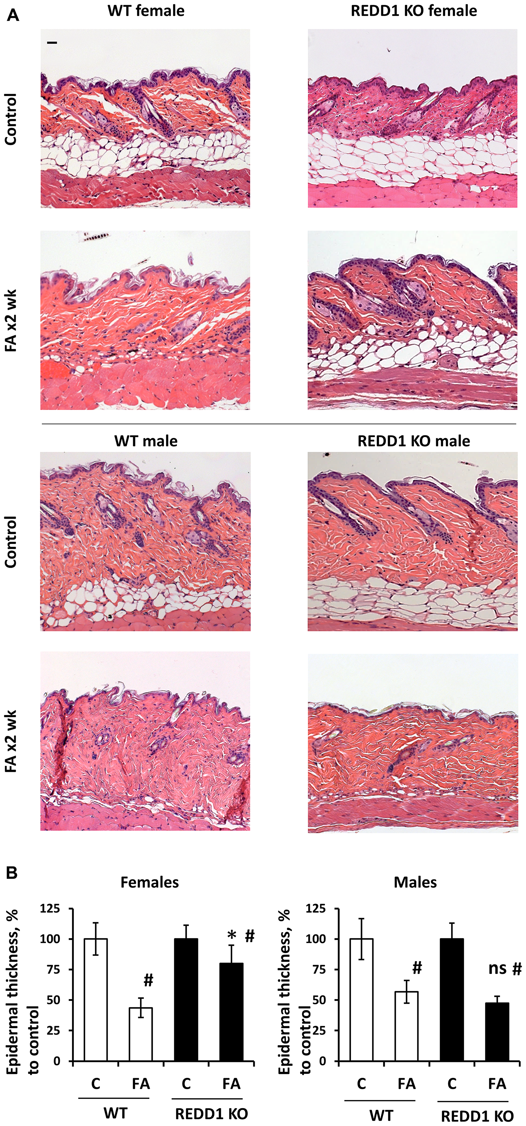 REDD1 KO female but not male mice are protected against glucocorticoid FA-induced skin atrophy