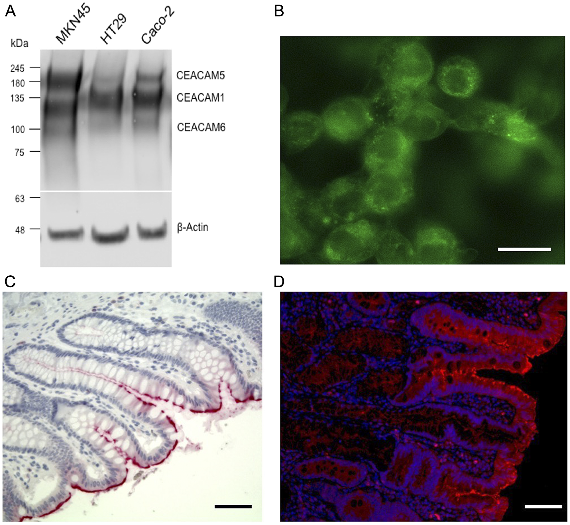 Colon cancer cell line western blot, fluorescence staining and immunohistochemistry of CEACAM expression