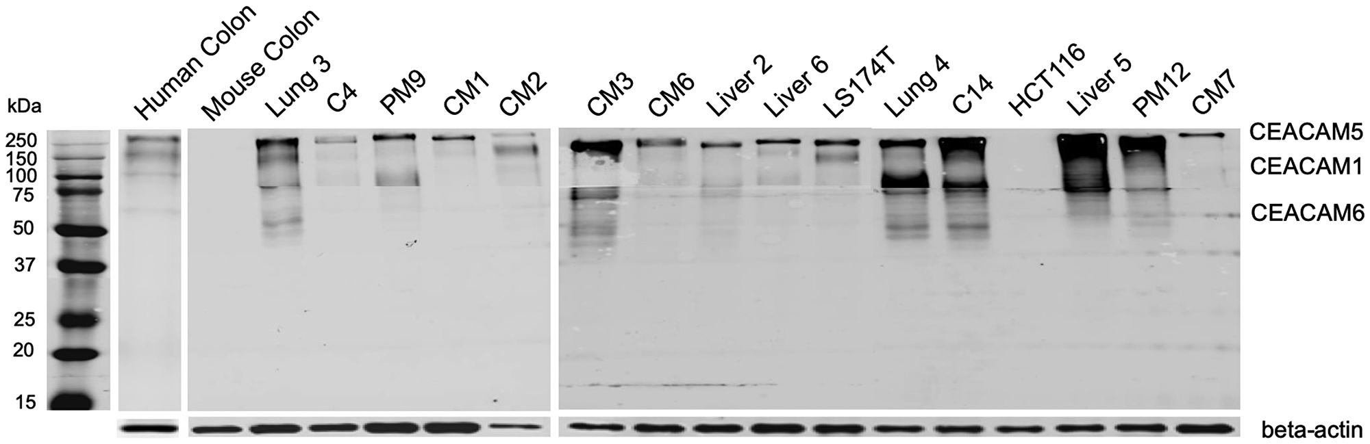 Whole membrane western blot of 6G5j-IR800CW for CEACAM expression in colon cancer lysates