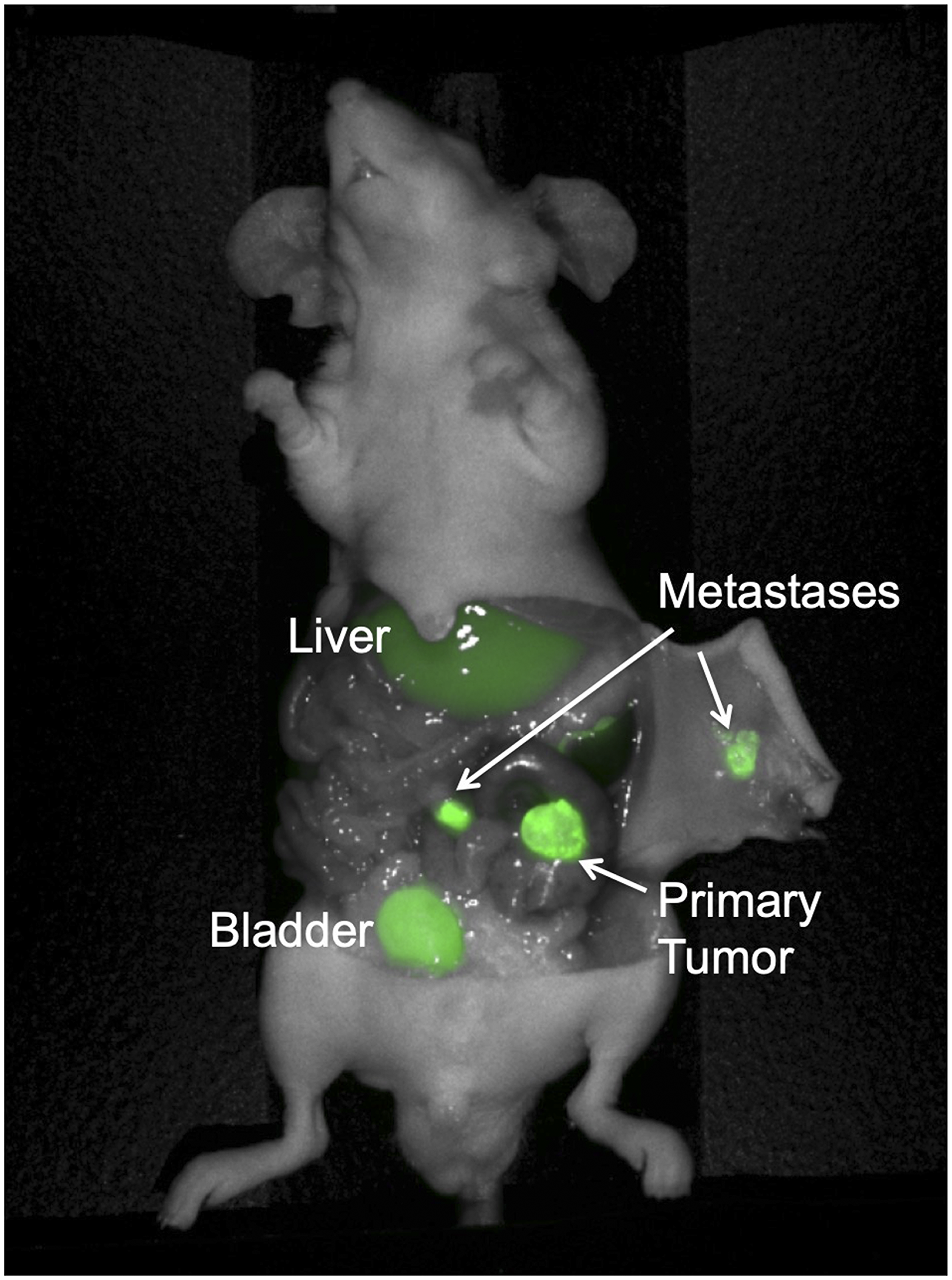 Colon cancer PDOX model with regional metastases, implanted on the cecum with patient-derived primary colon tumor sample Lung 4