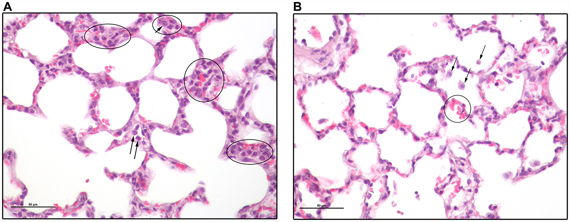 Lung sections of a 2CLP+NCs rat 4 days following the 2CLP-operation
