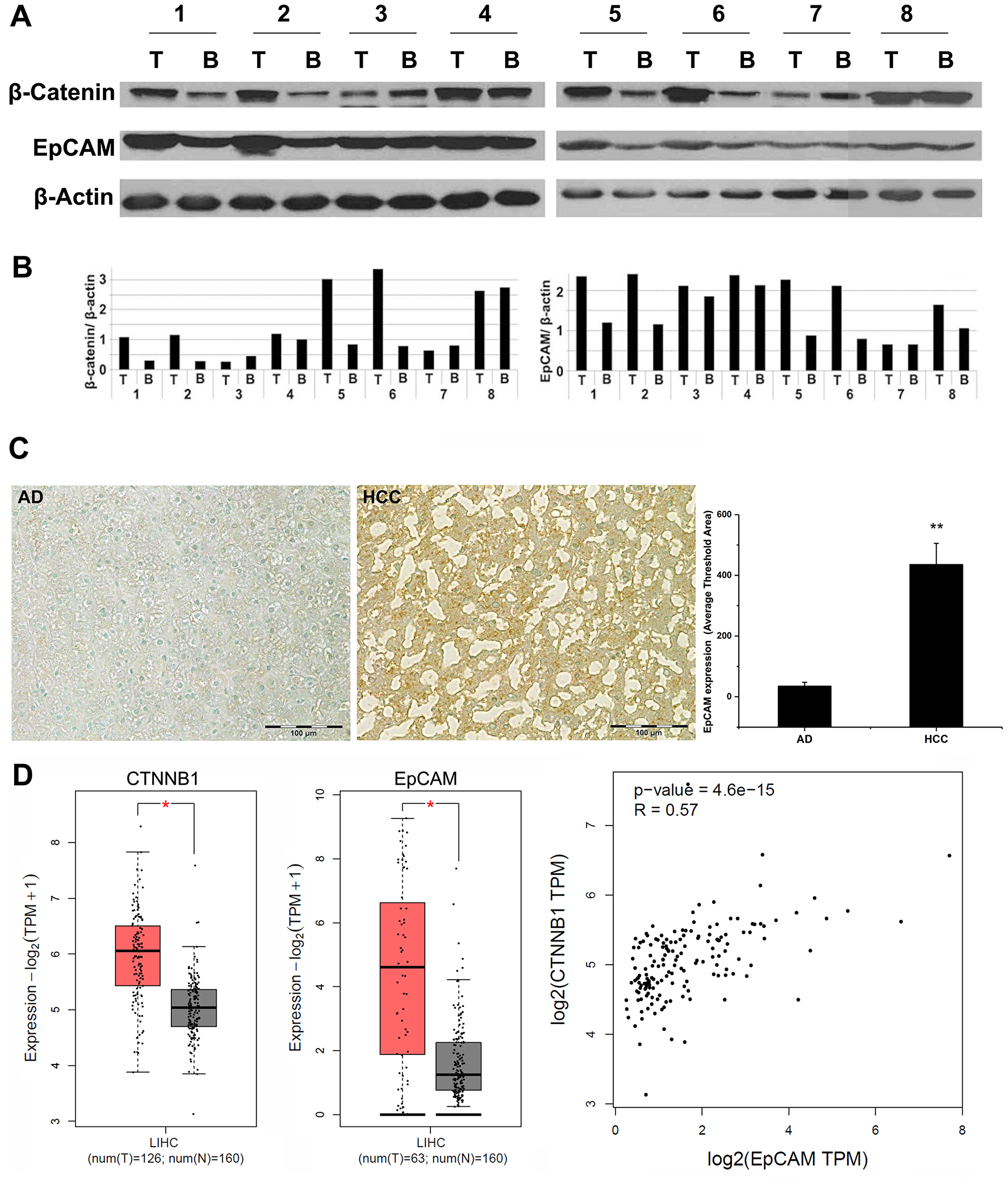 Analysis of human HCC specimens