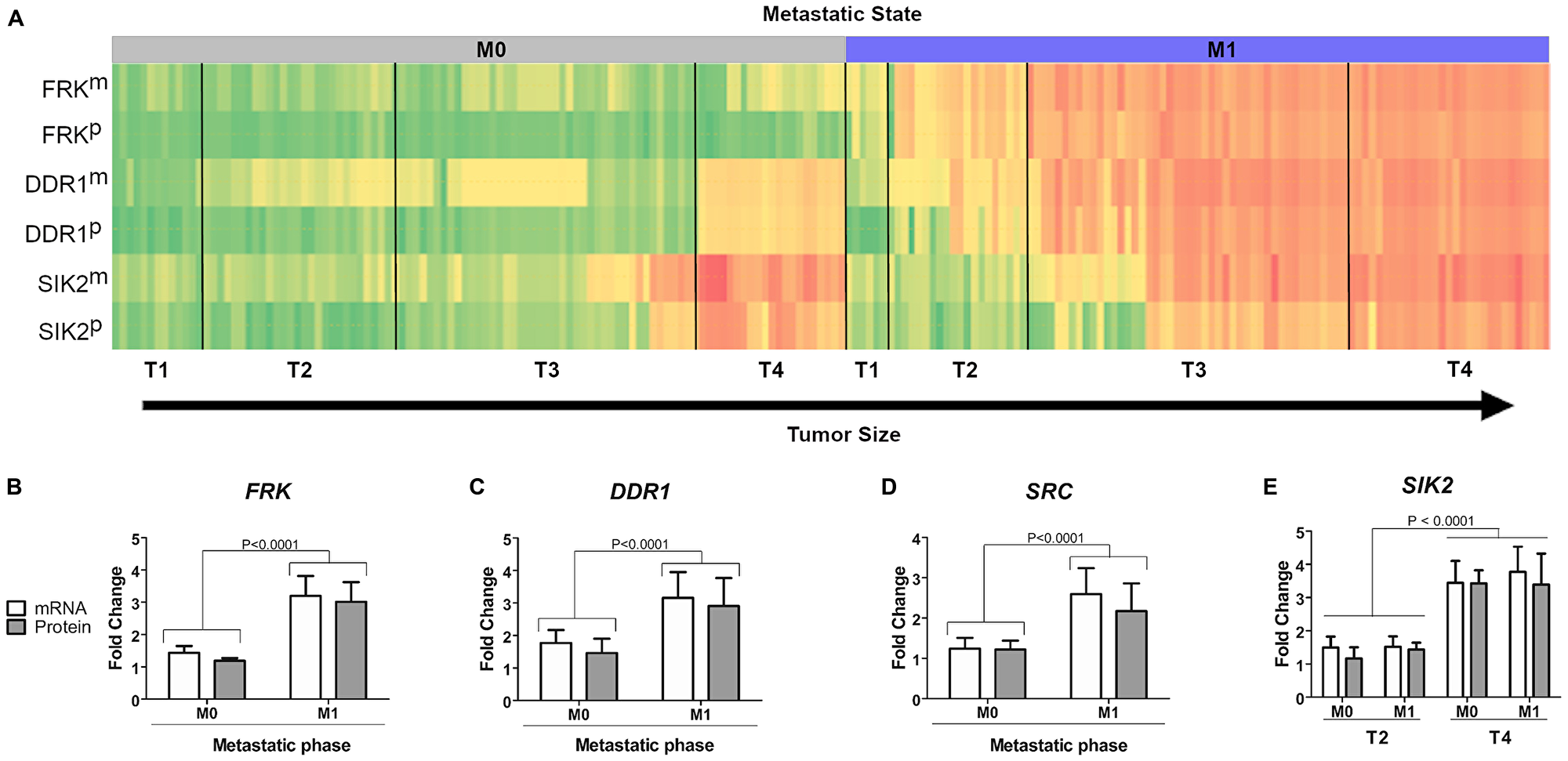 Correlation between kinase expression levels and tumor stage in patient samples