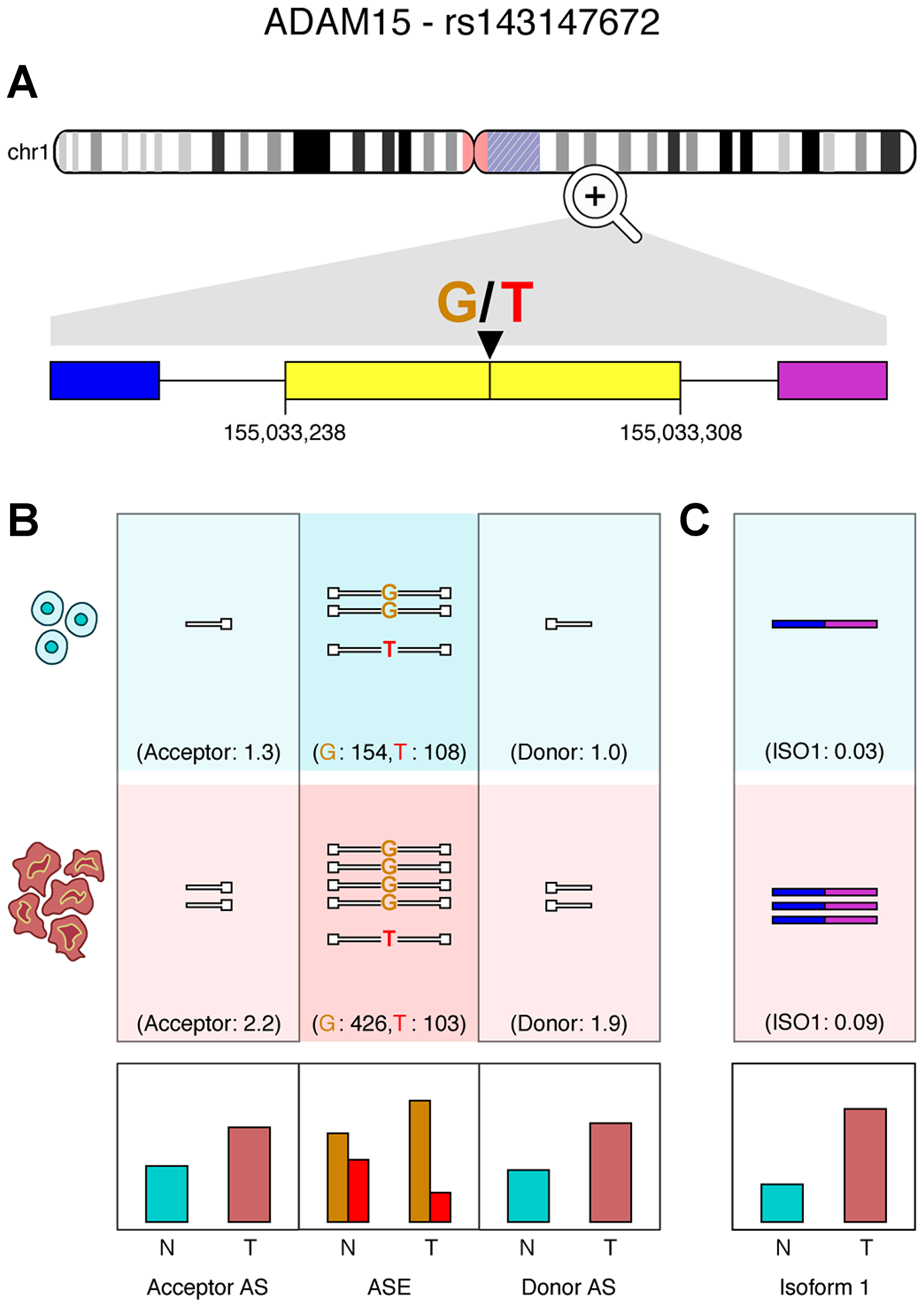 ADAM15 exon skipping correlates with ASE in a breast adenocarcinoma patient
