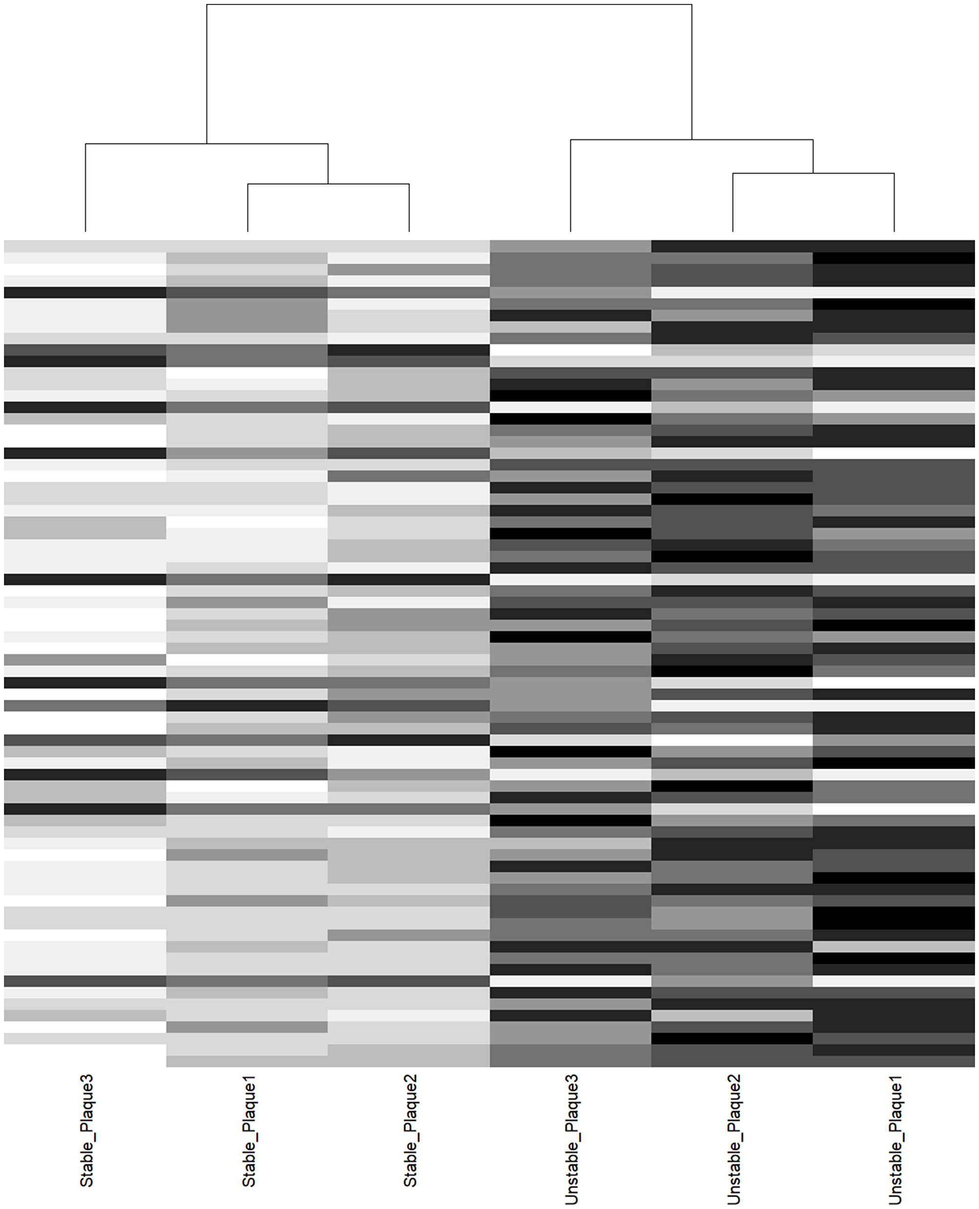 Cluster analysis of donor-matched aortic plaque samples