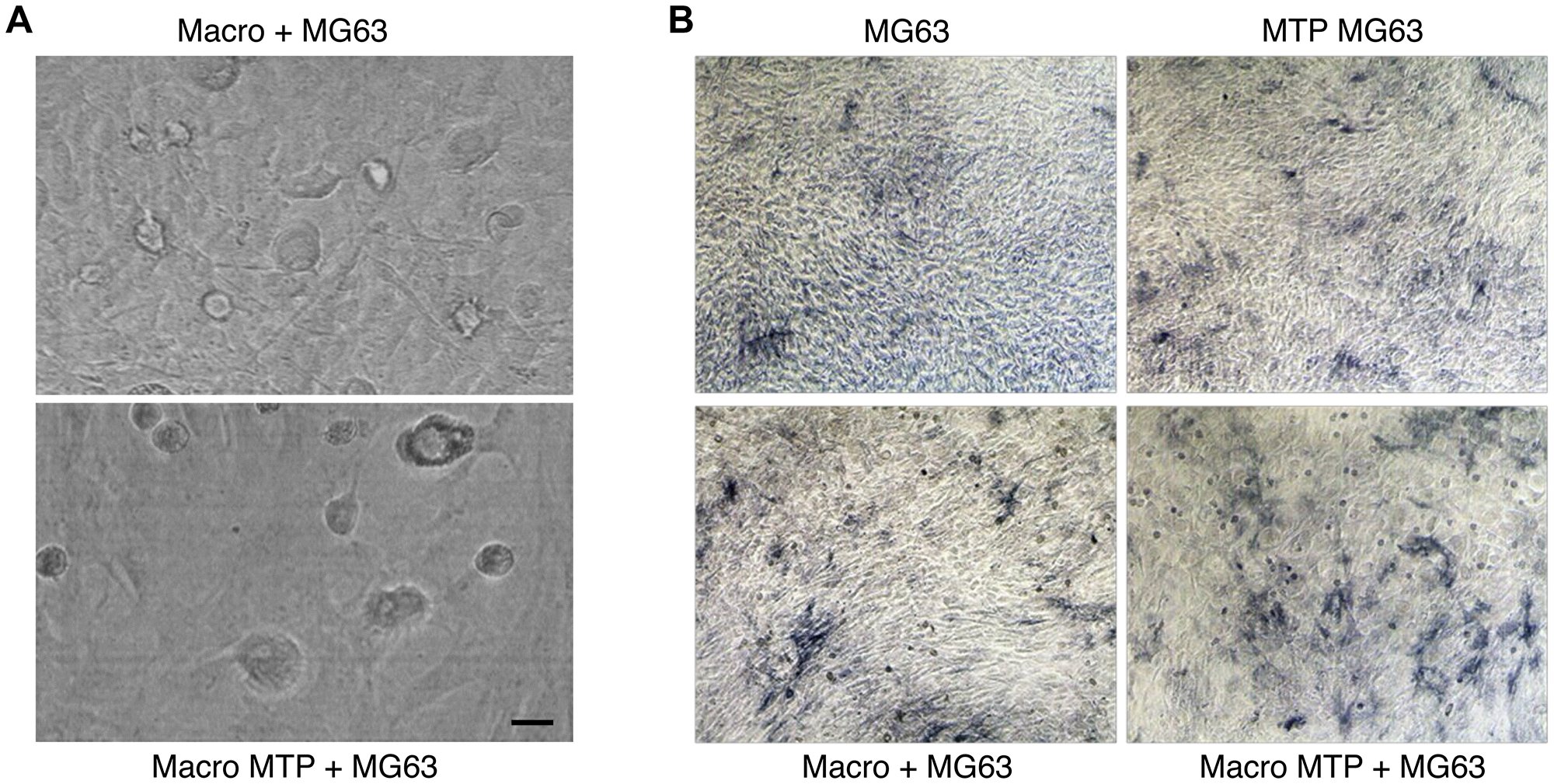Effects of Mifamurtide (MTP) on MG63 alone and co-cultured with macrophages