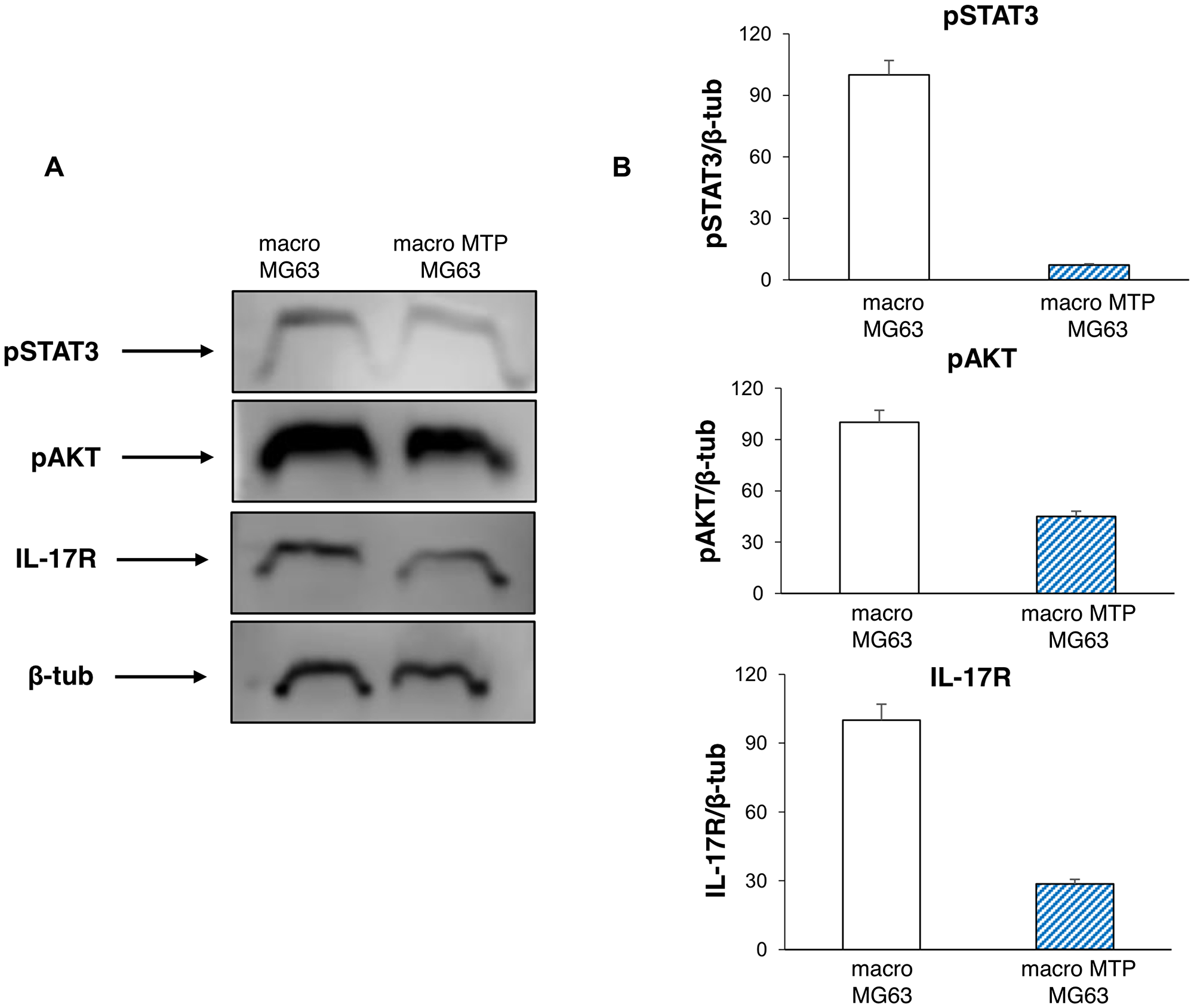 Effects of Mifamurtide (MTP) on proliferation and invasive properties of MG63 co-cultured with macrophages