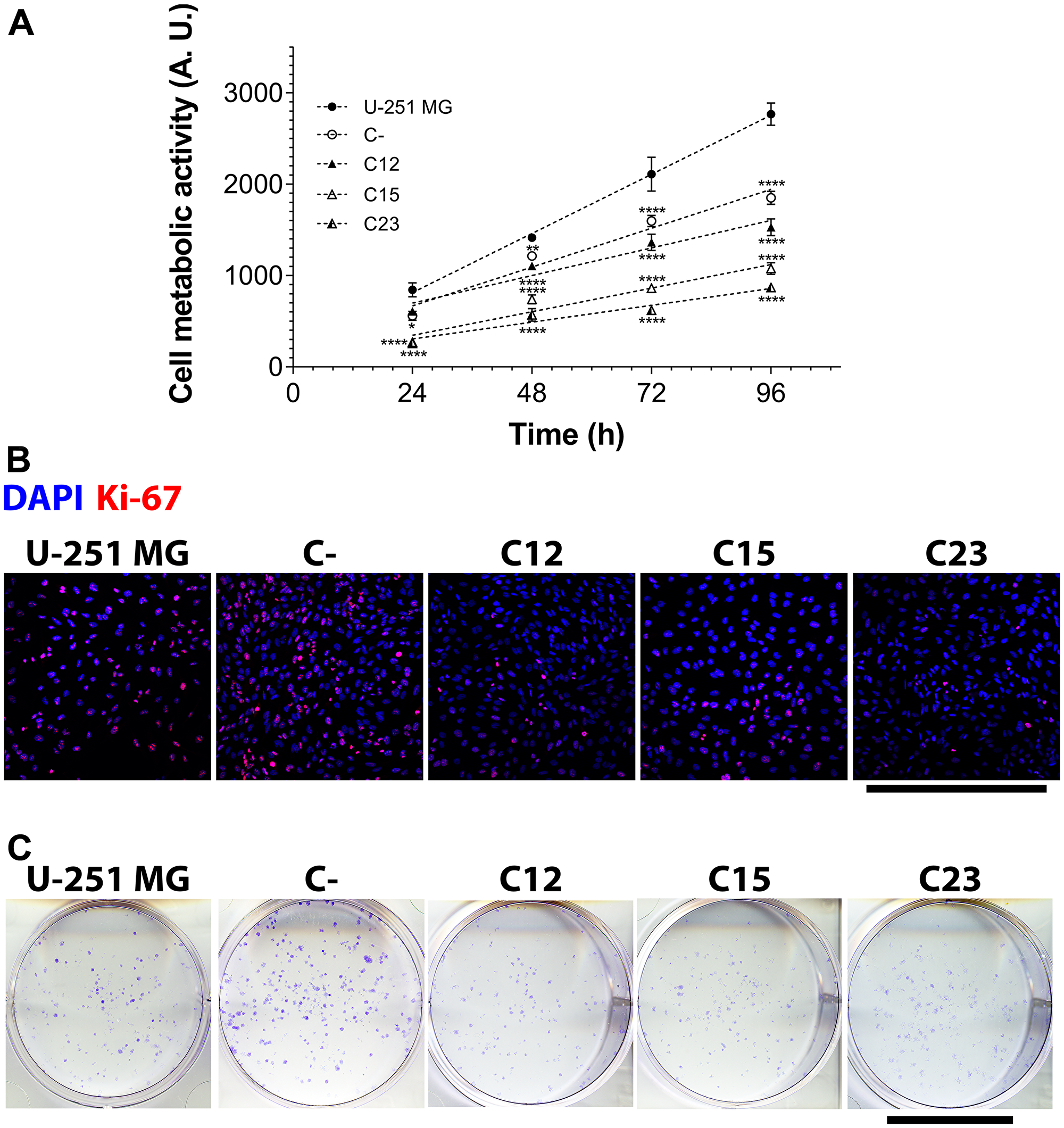 Cell metabolic activity, proliferation, and clonogenicity assays to assess GPC1 effects in GBM cells