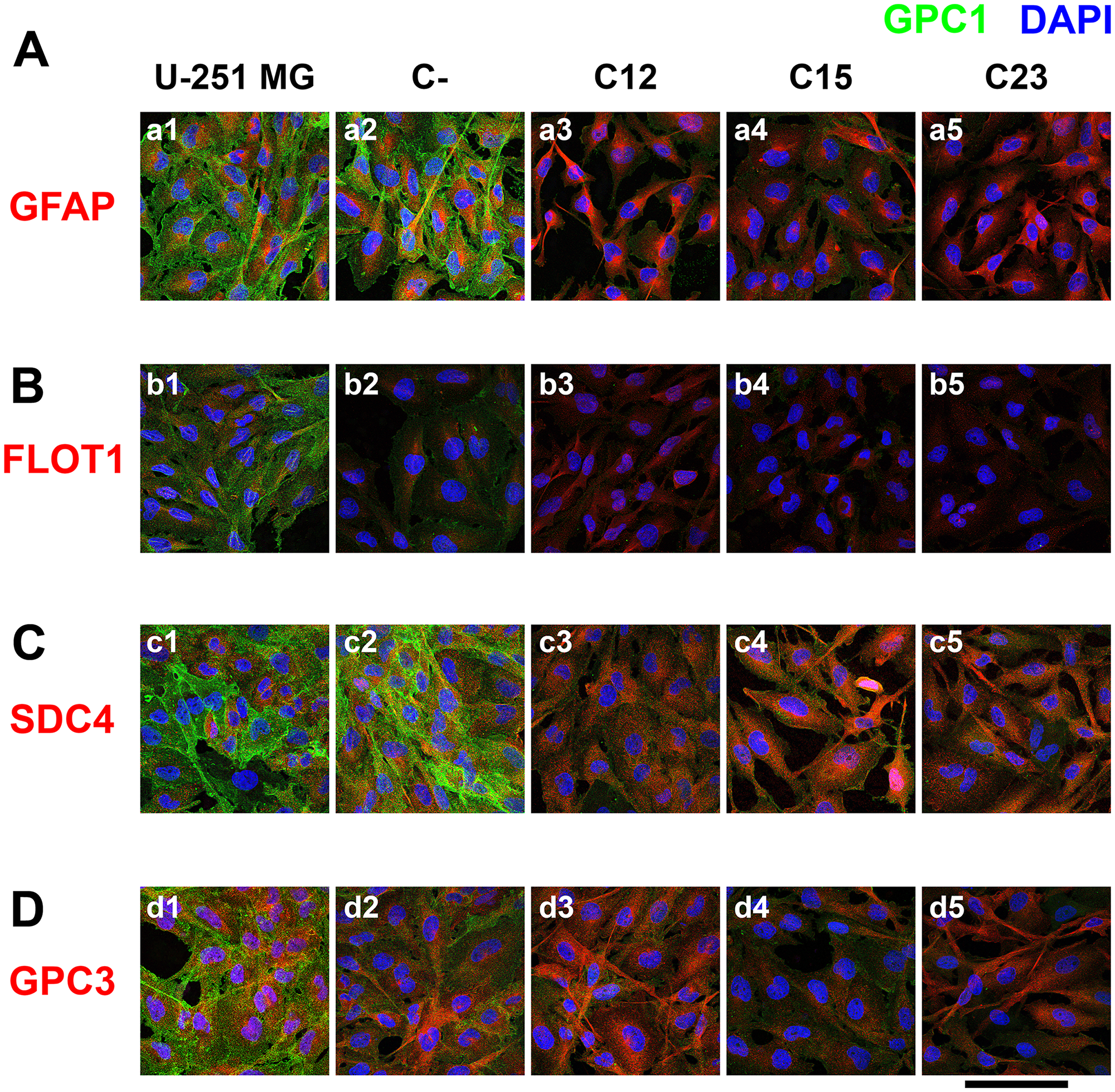 Confocal microscopy of immunolabeled GBM control and GPC1-silenced cells for a lipid raft marker or correlated HSPGs