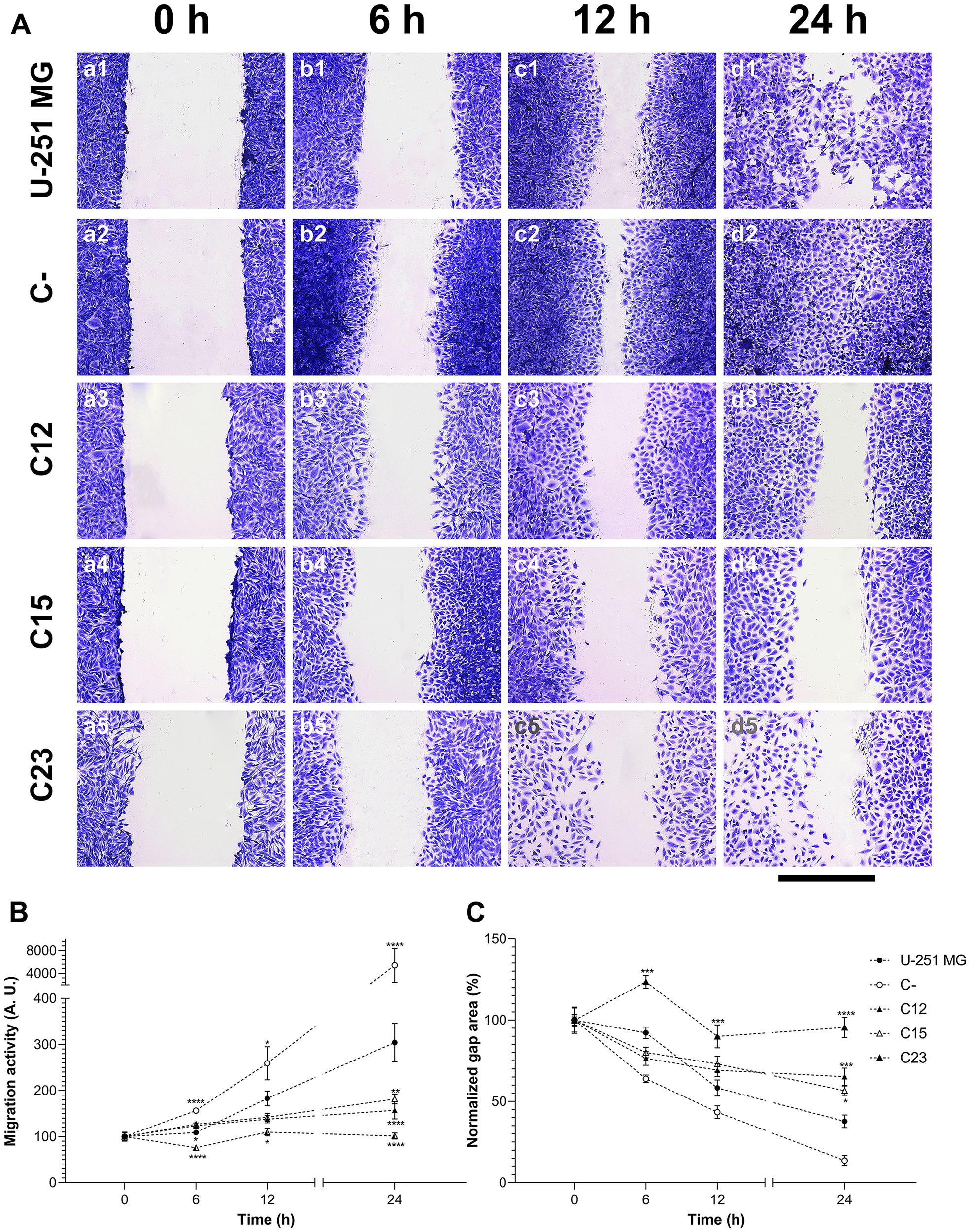 Migration assessment on GBM cells to establish the effects of GPC1