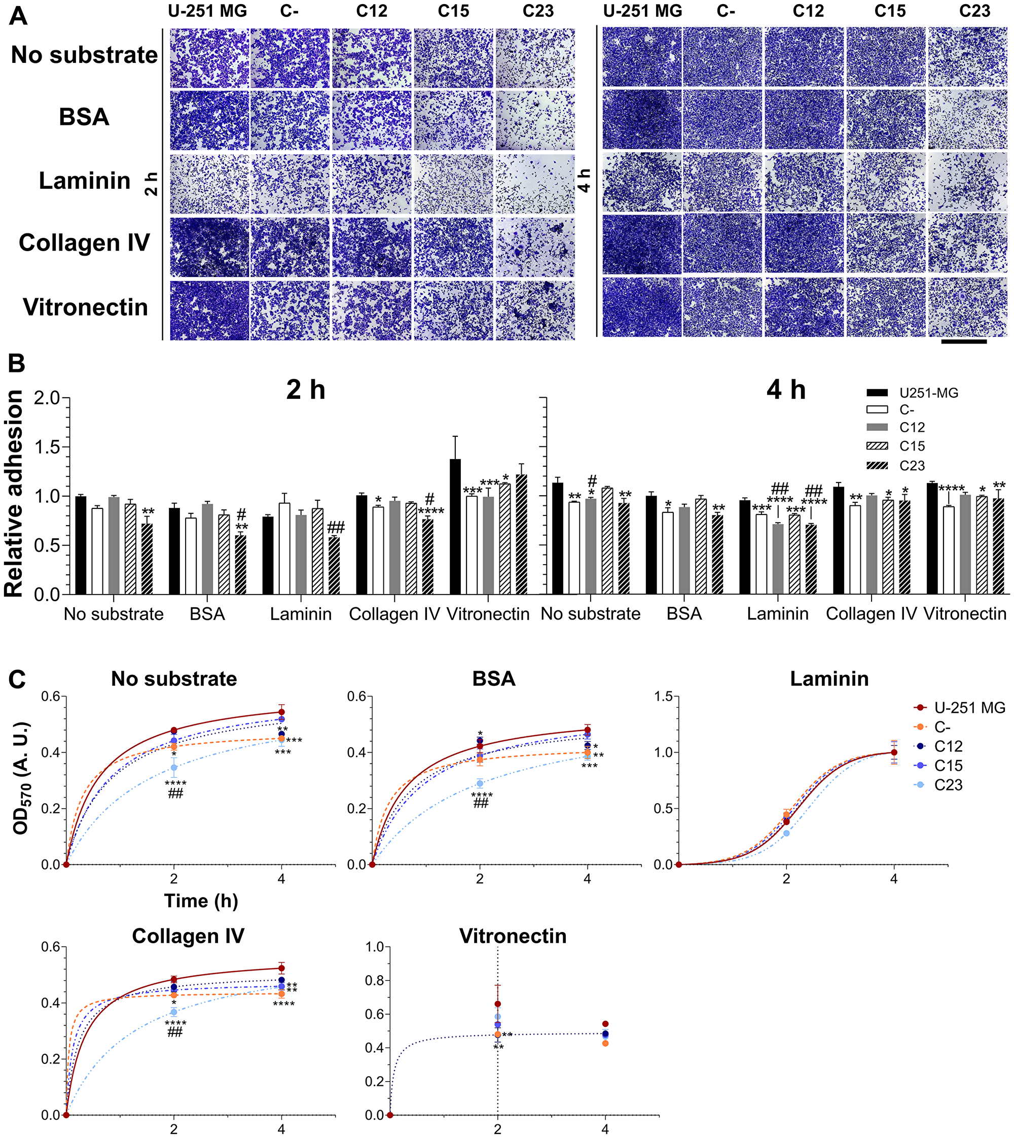Investigation of GPC1’s role in adhesion of GBM cells