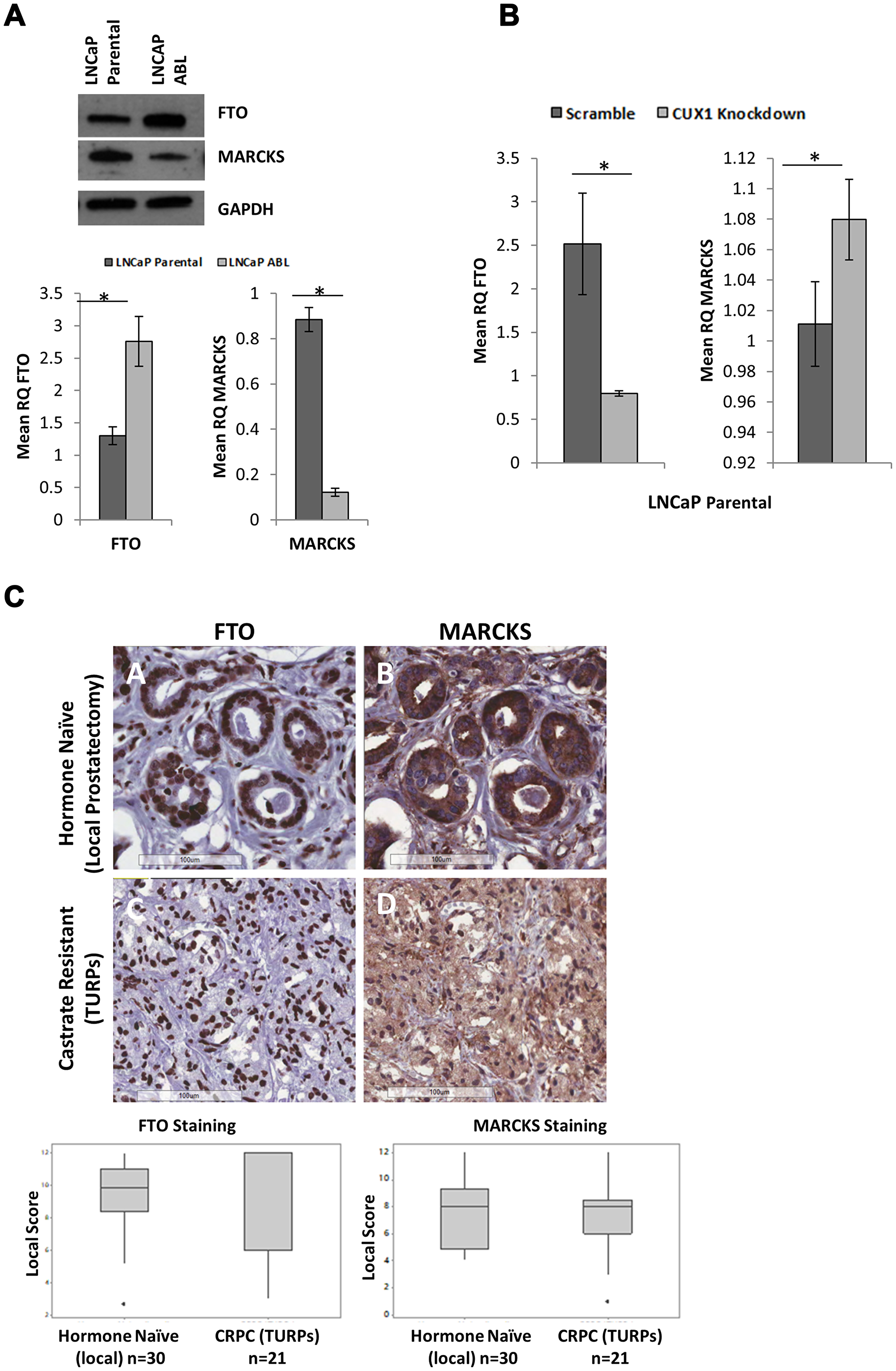 Surrogate Markers of CUX1 are not differentially expressed in hormone naïve and castrate resistant prostate cancer