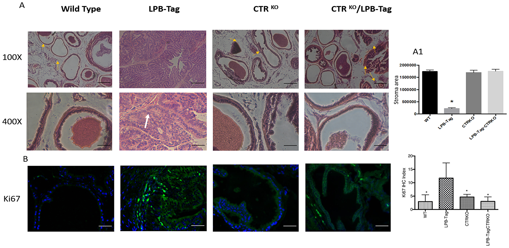 H & E staining of prostate tissue and Ki67 immunoreactivity