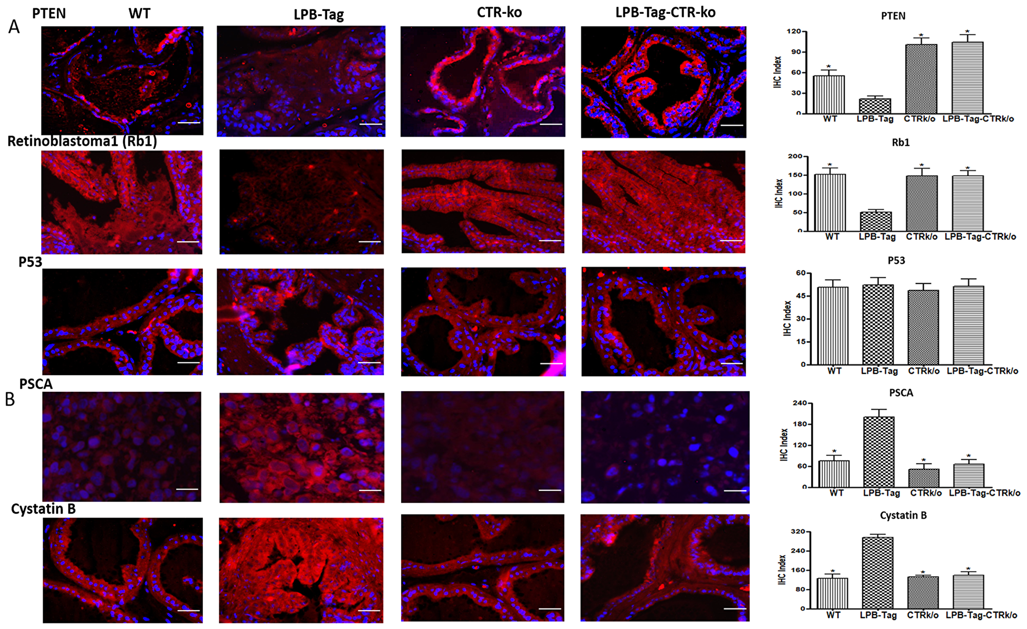 Immunoreactivity of tumor suppressor genes