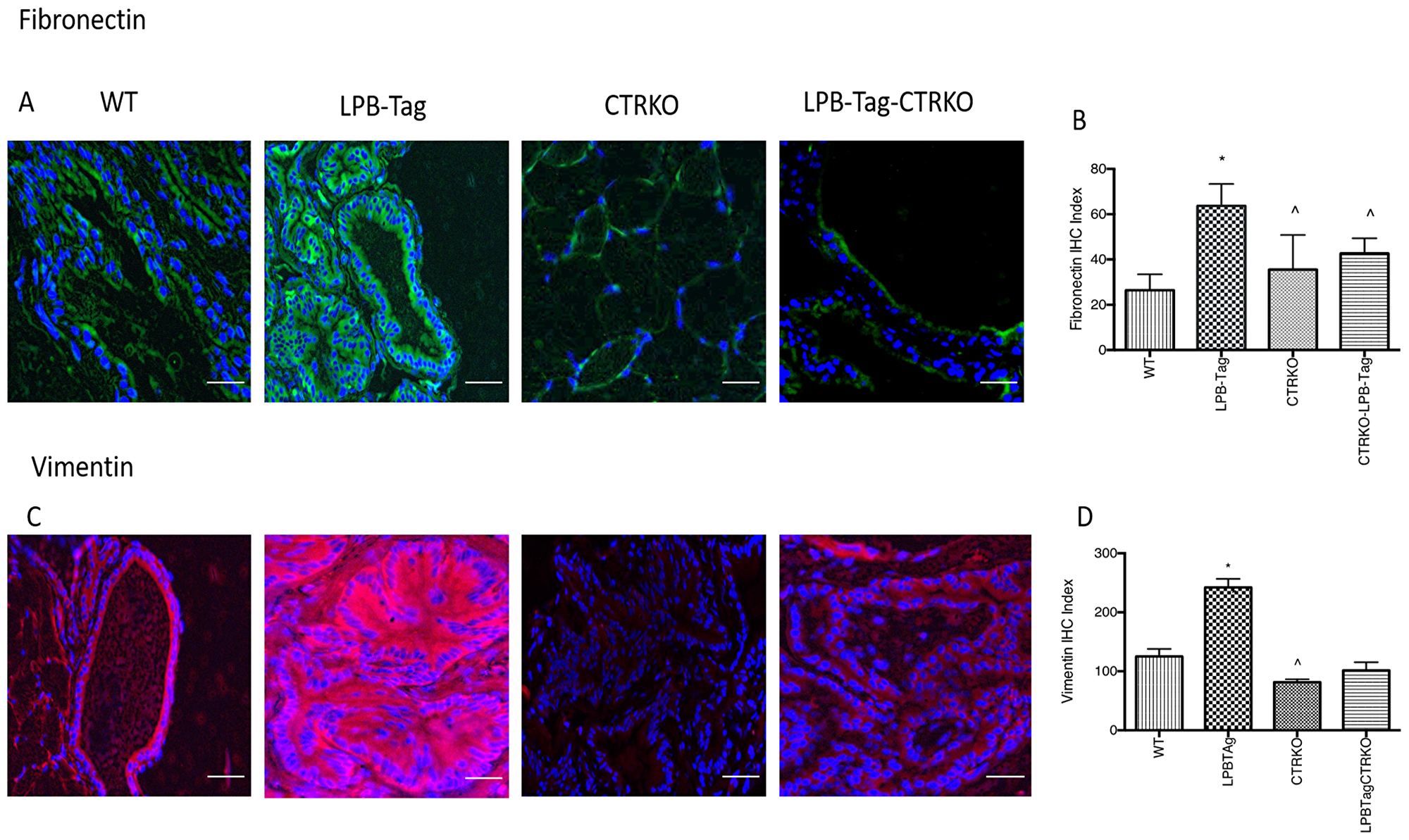Immunoreactivity of fibronectin and vimentin
