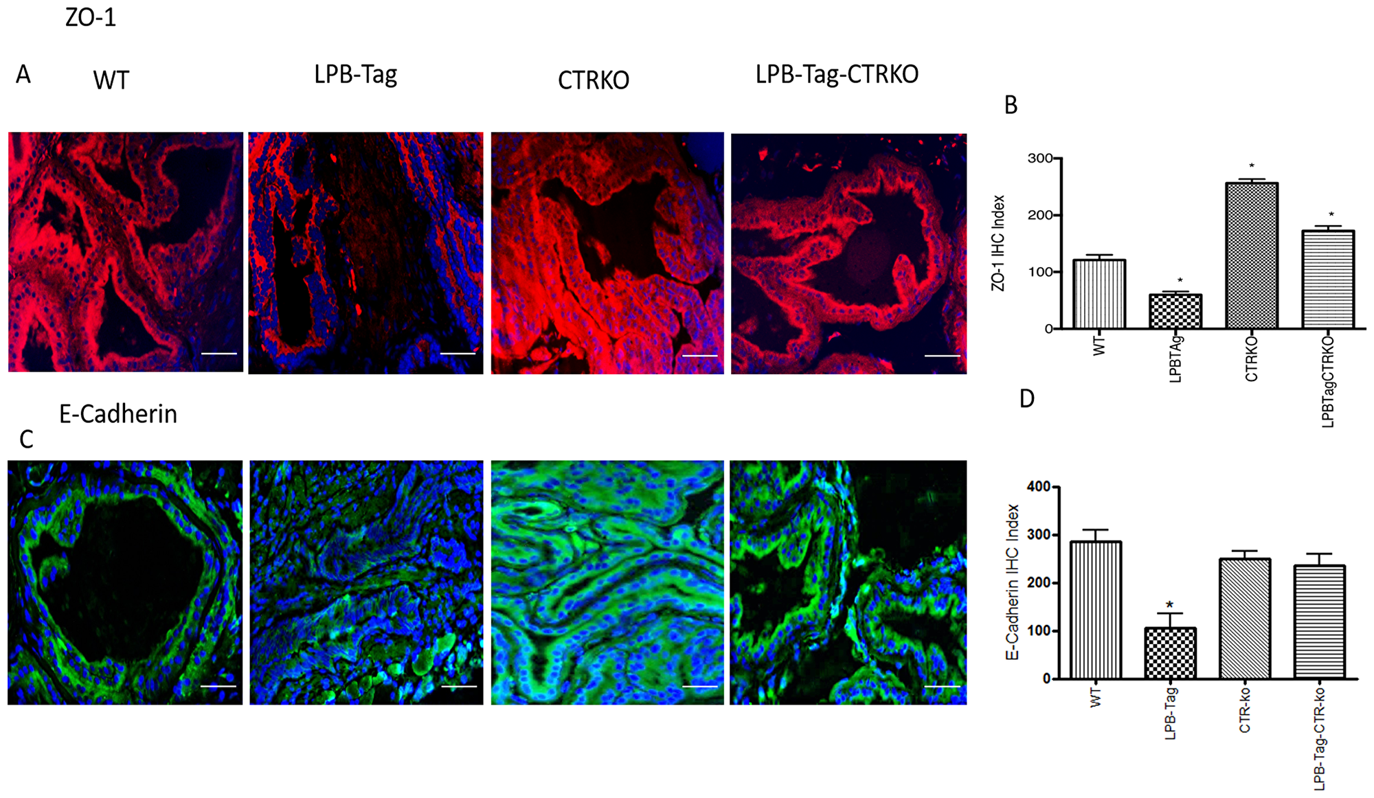 Immunoreactivity of ZO-1 and E-cadherin