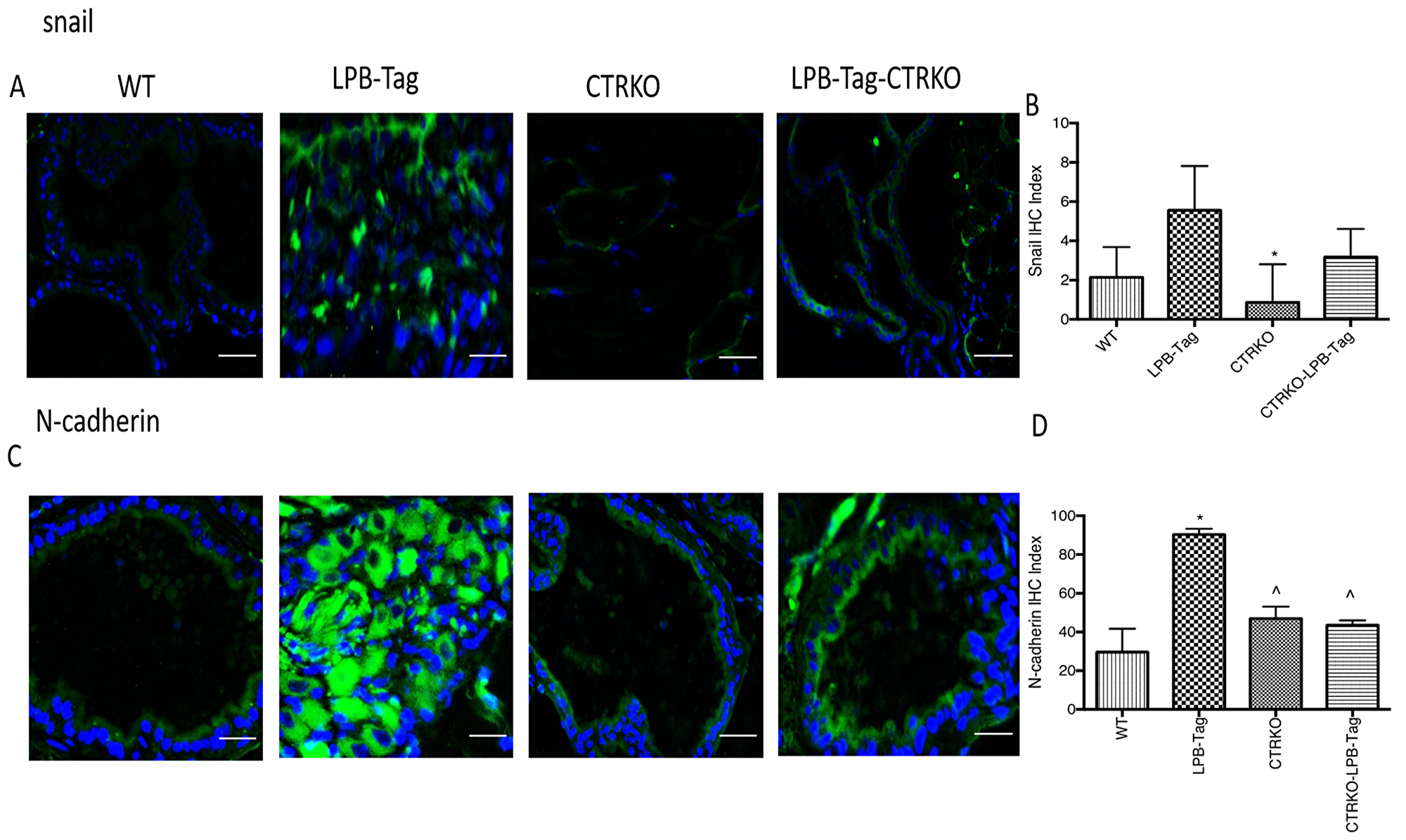Immunoreactivity of snail and N-cadherin