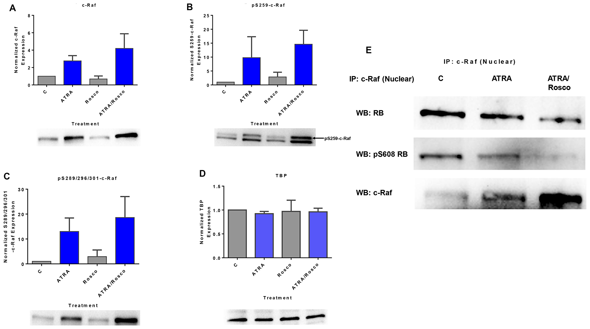 Roscovitine enhances the amount of ATRA-induced phosphorylated c-Raf and phosphorylated c-Raf in the nucleus modulates the RB protein functions