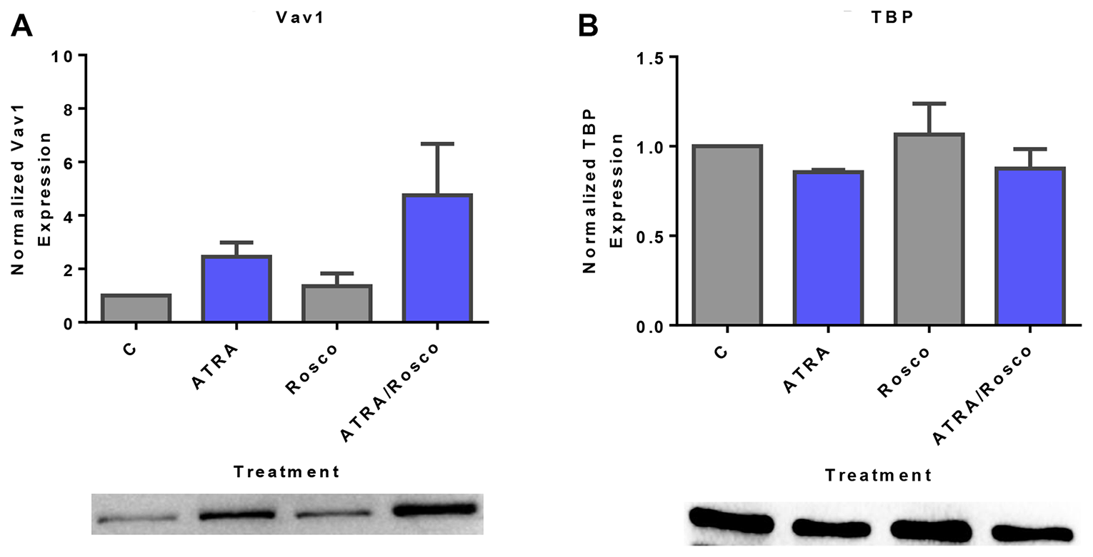 Roscovitine increases ATRA-induced nuclear expression of Vav1