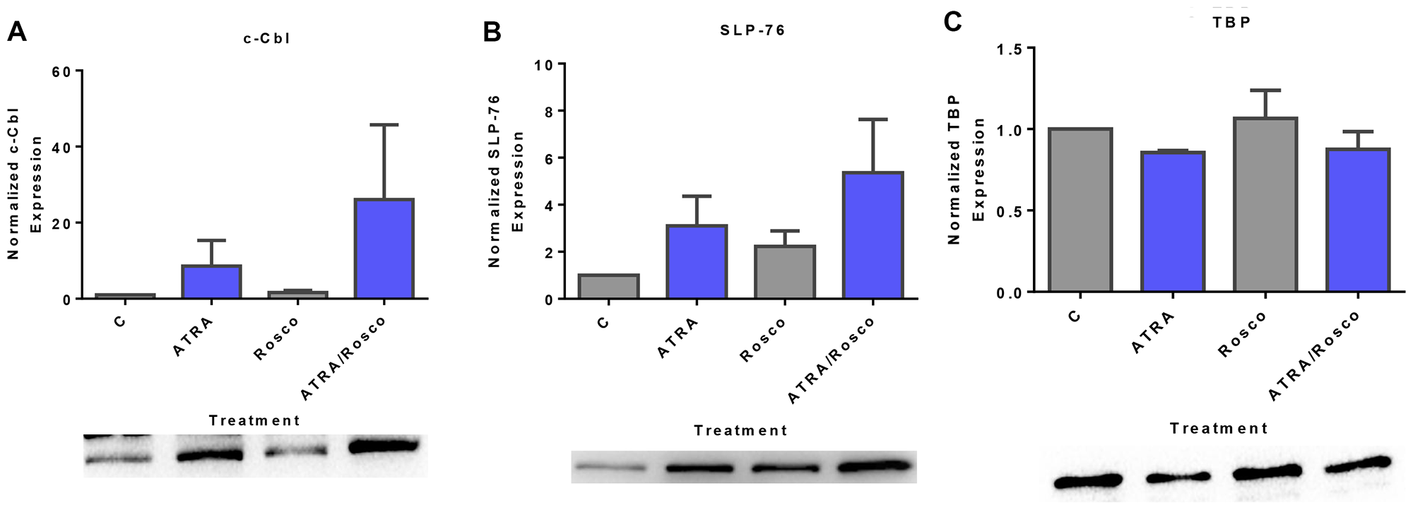 Expression of adaptor proteins (c-Cbl, SLP-76) in the nucleus is enhanced by ATRA and roscovitine